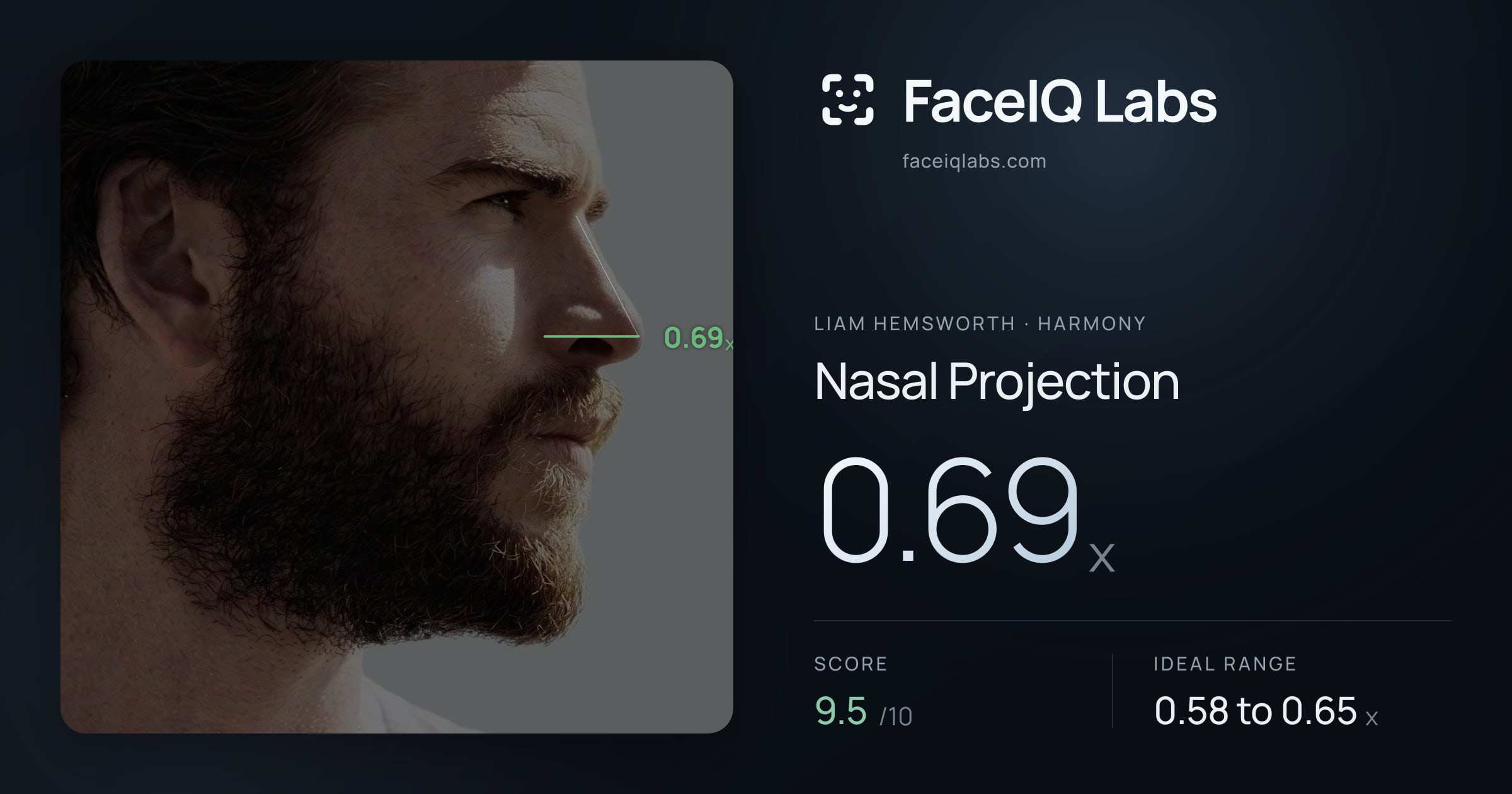 Liam Hemsworth Nasal Projection: 0.69x, drawn on the photo