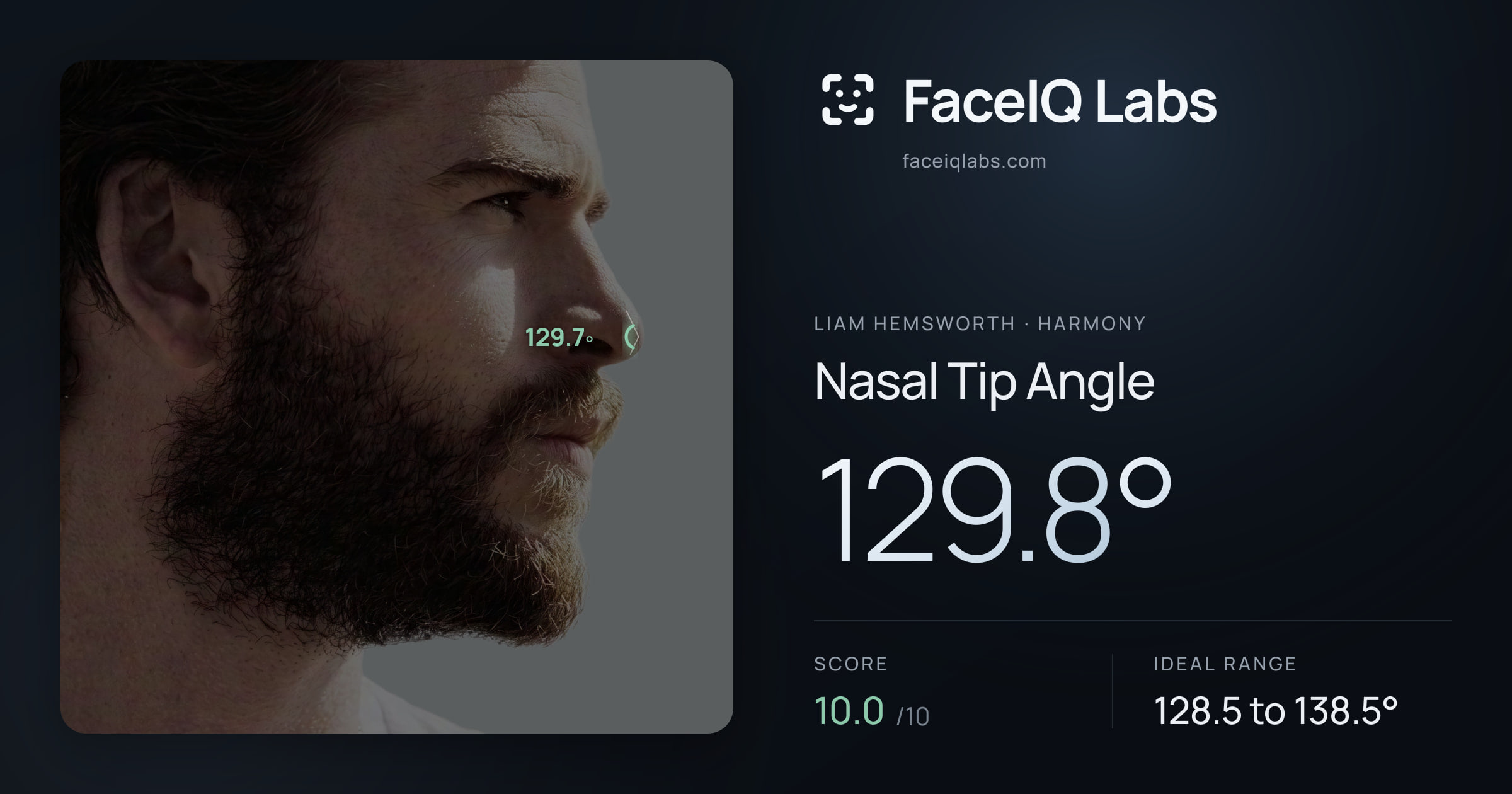 Liam Hemsworth Nasal Tip Angle: 129.8°, drawn on the photo