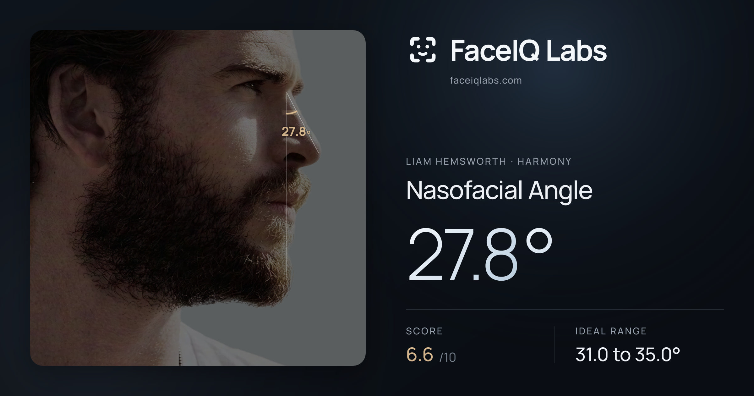 Liam Hemsworth Nasofacial Angle: 27.8°, drawn on the photo