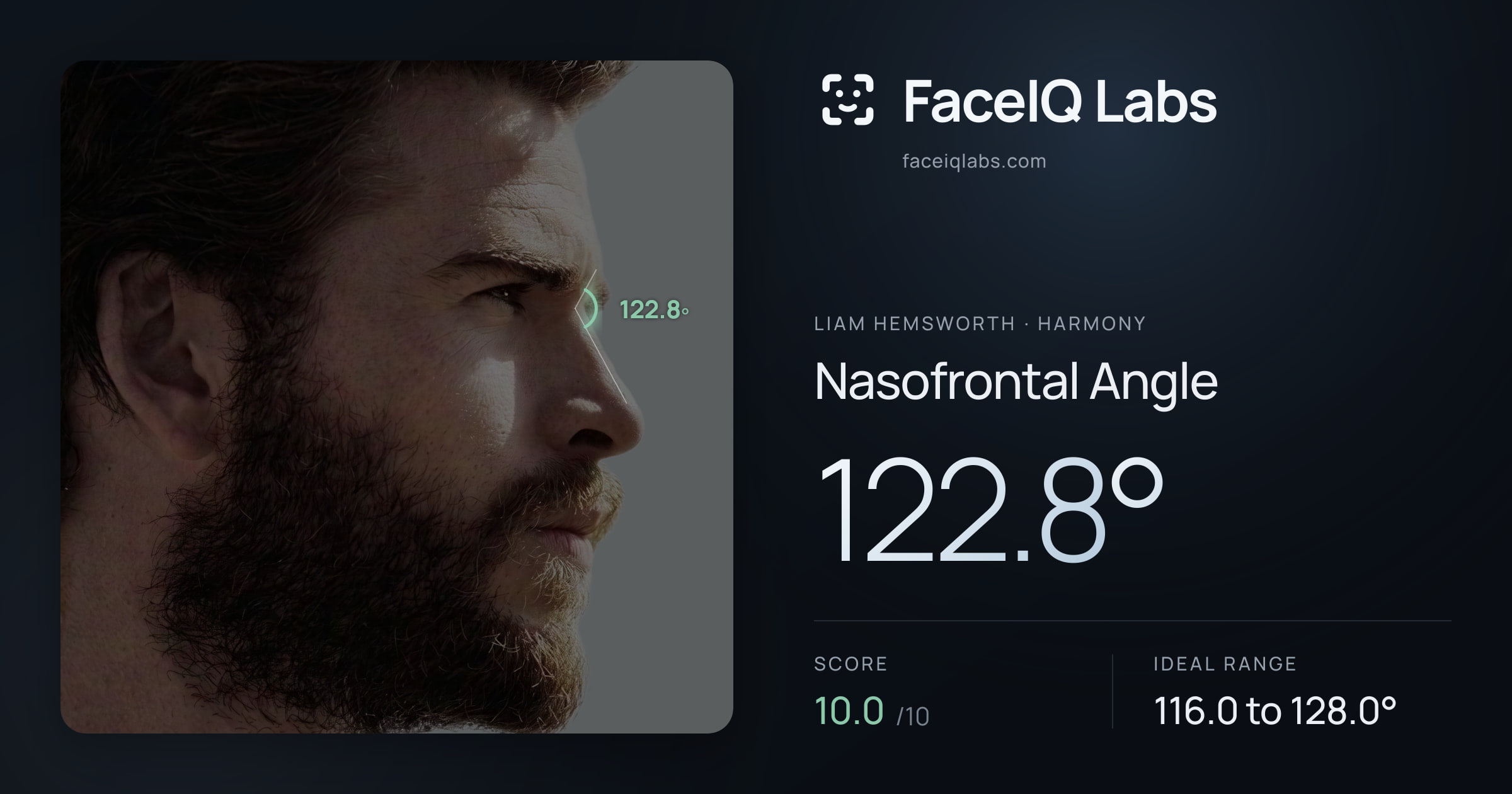 Liam Hemsworth Nasofrontal Angle: 122.8°, drawn on the photo