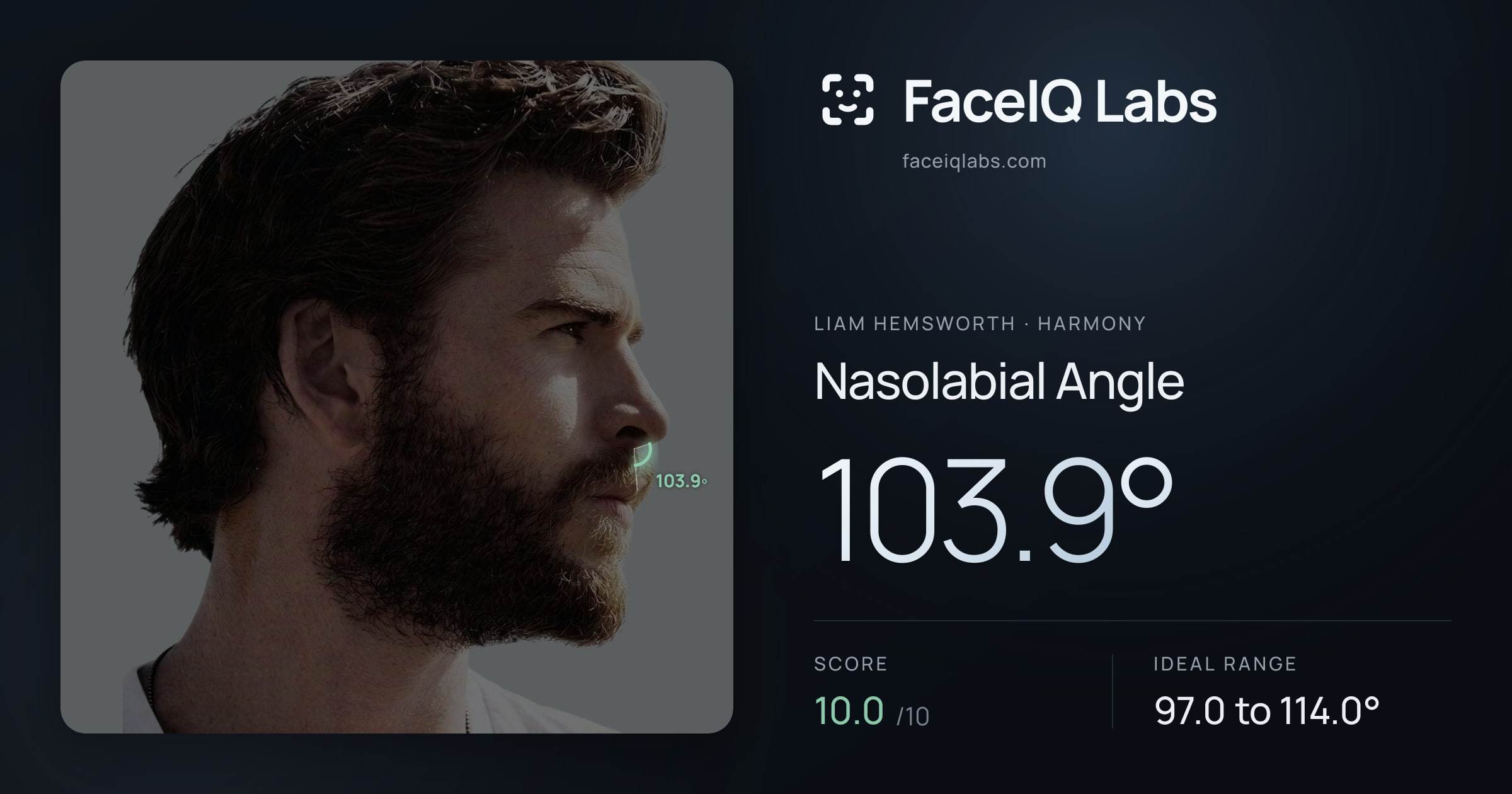 Liam Hemsworth Nasolabial Angle: 103.9°, drawn on the photo