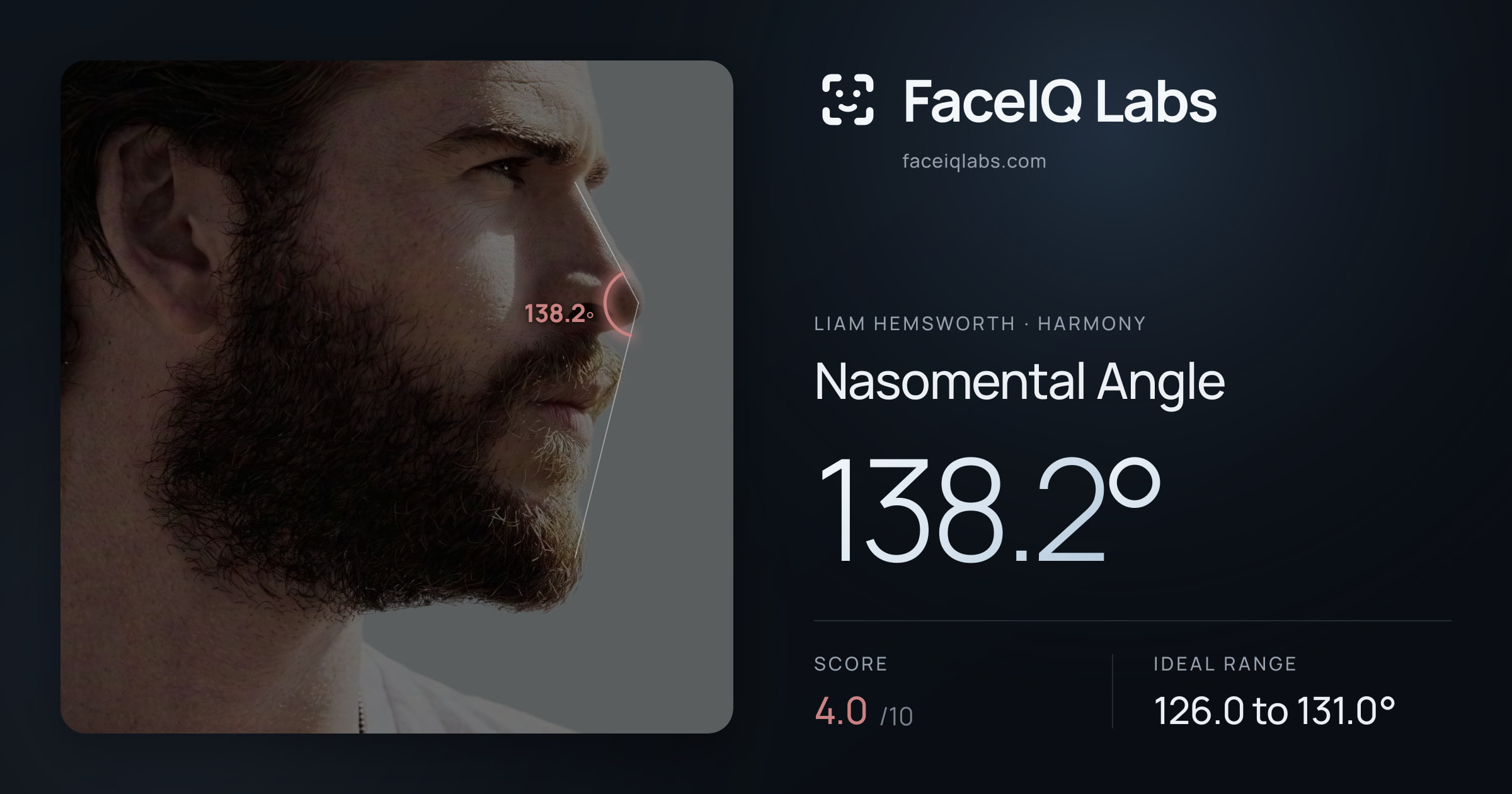 Liam Hemsworth Nasomental Angle: 138.2°, drawn on the photo