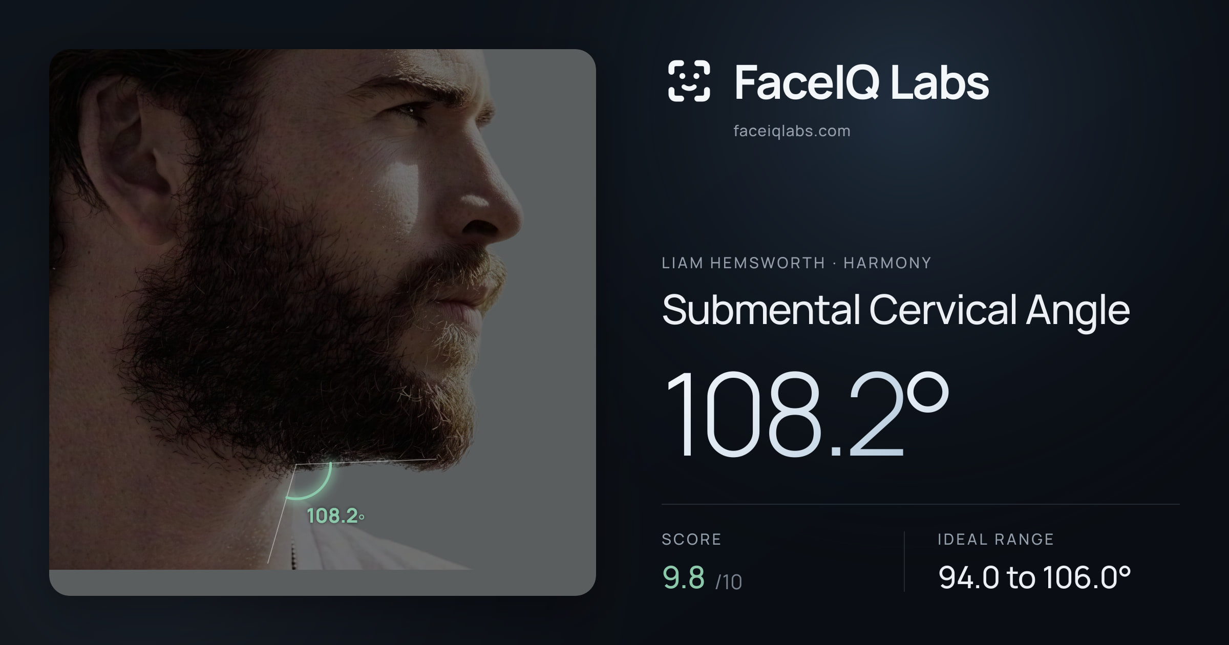 Liam Hemsworth Submental Cervical Angle: 108.2°, drawn on the photo