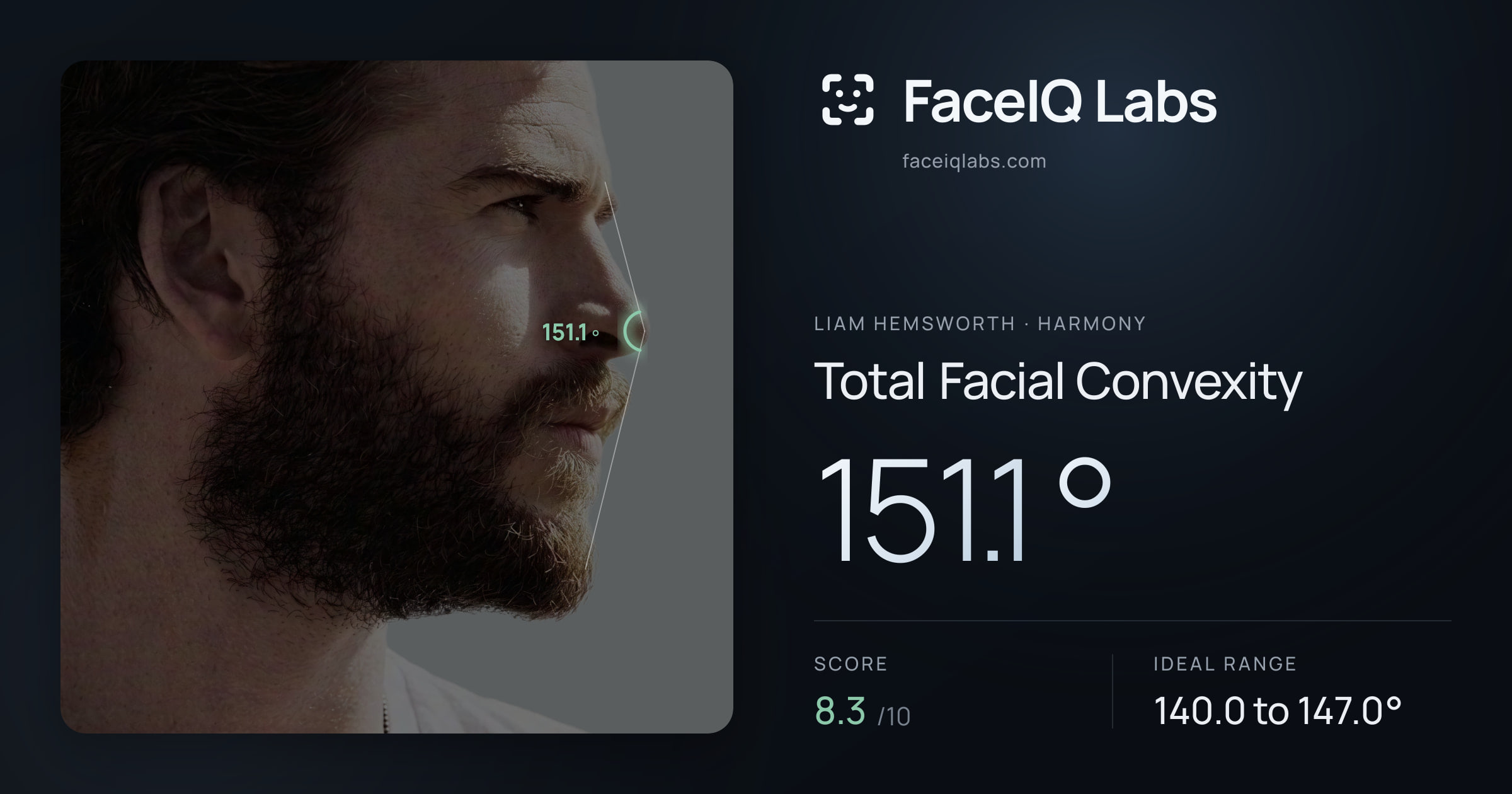 Liam Hemsworth Total Facial Convexity: 151.1°, drawn on the photo