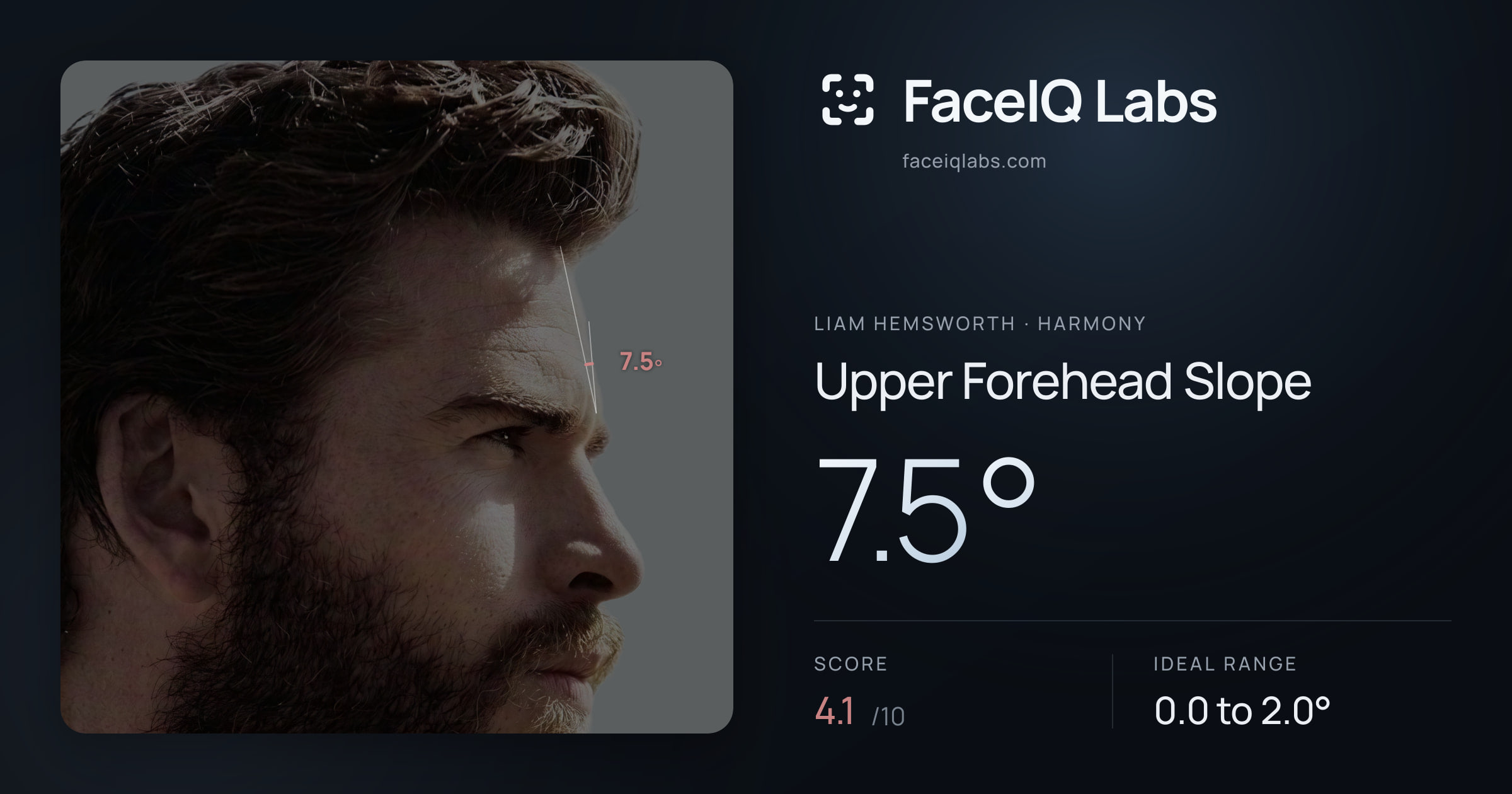 Liam Hemsworth Upper Forehead Slope: 7.5°, drawn on the photo