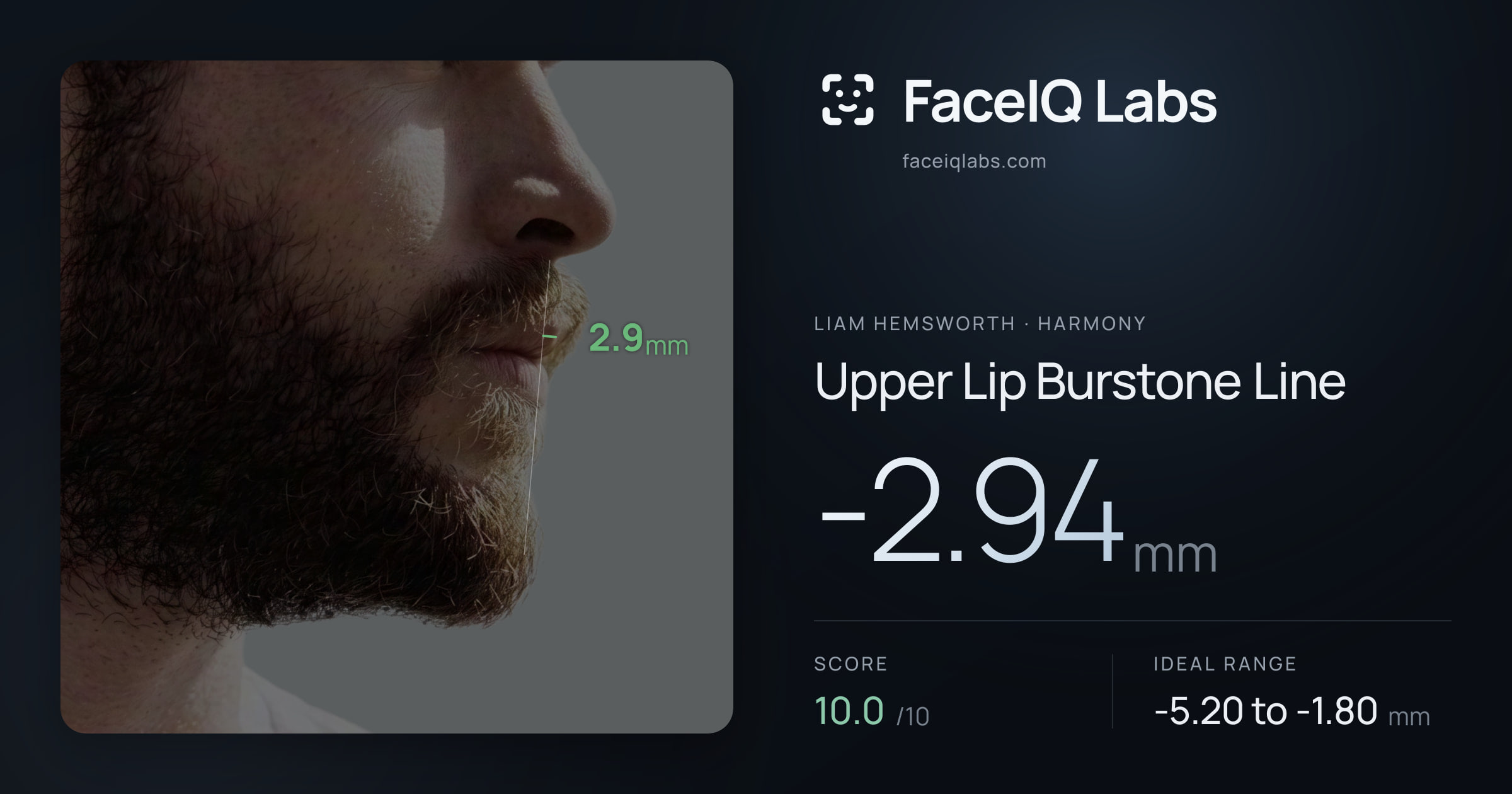 Liam Hemsworth Upper Lip Burstone Line: -2.94mm, drawn on the photo