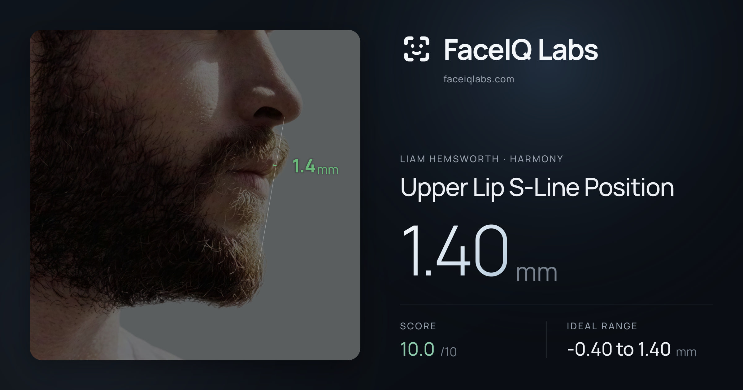 Liam Hemsworth Upper Lip S-Line Position: 1.40mm, drawn on the photo