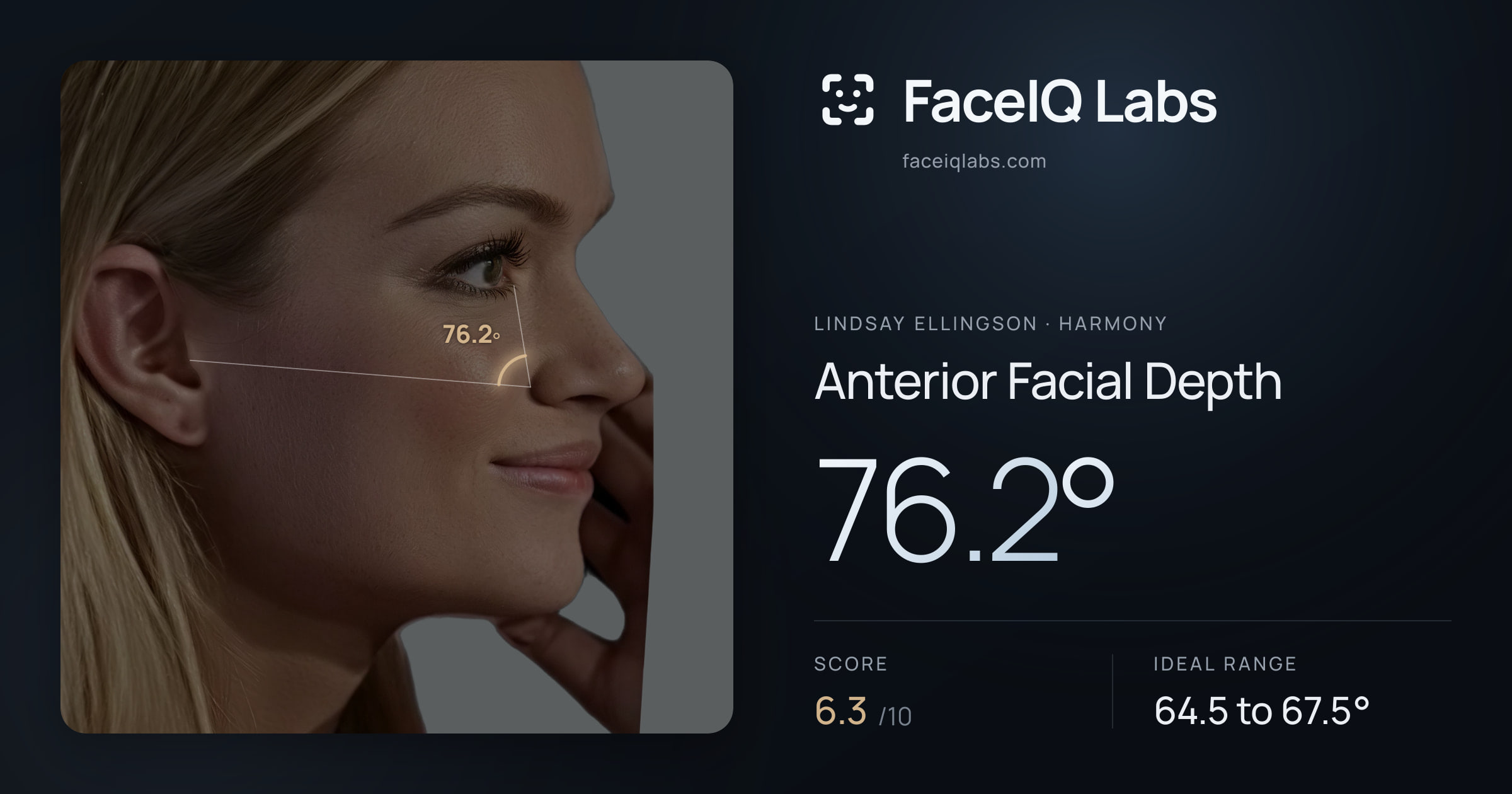 Lindsay Ellingson Anterior Facial Depth: 76.2°, drawn on the photo