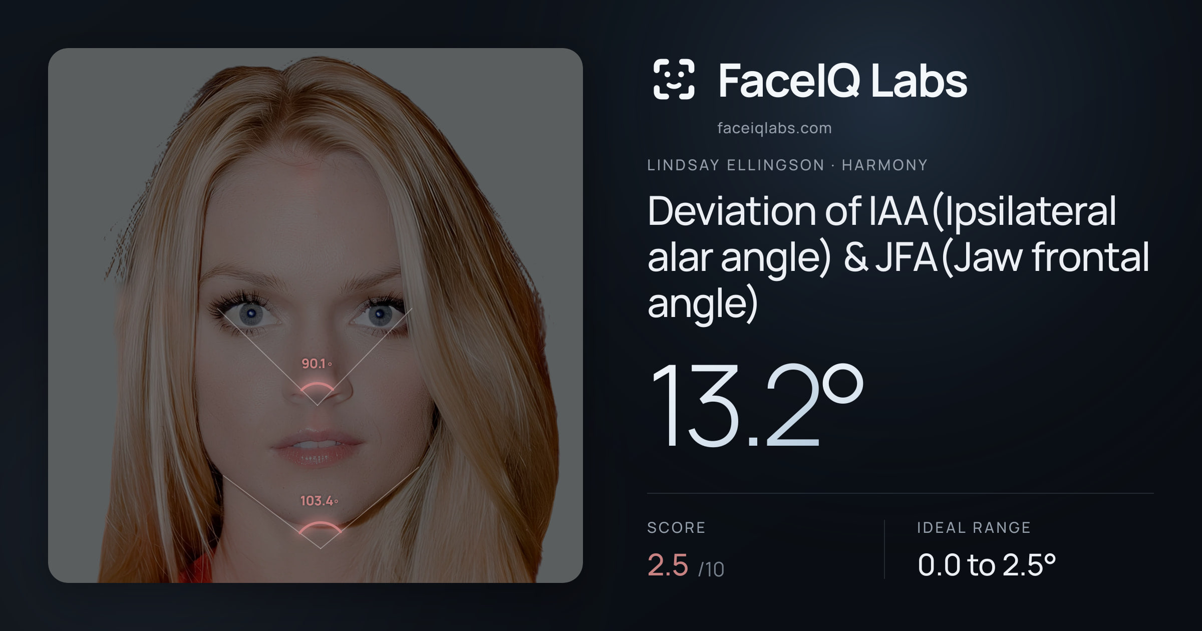 Lindsay Ellingson Deviation of IAA(Ipsilateral alar angle) & JFA(Jaw frontal angle): 13.2°, drawn on the photo