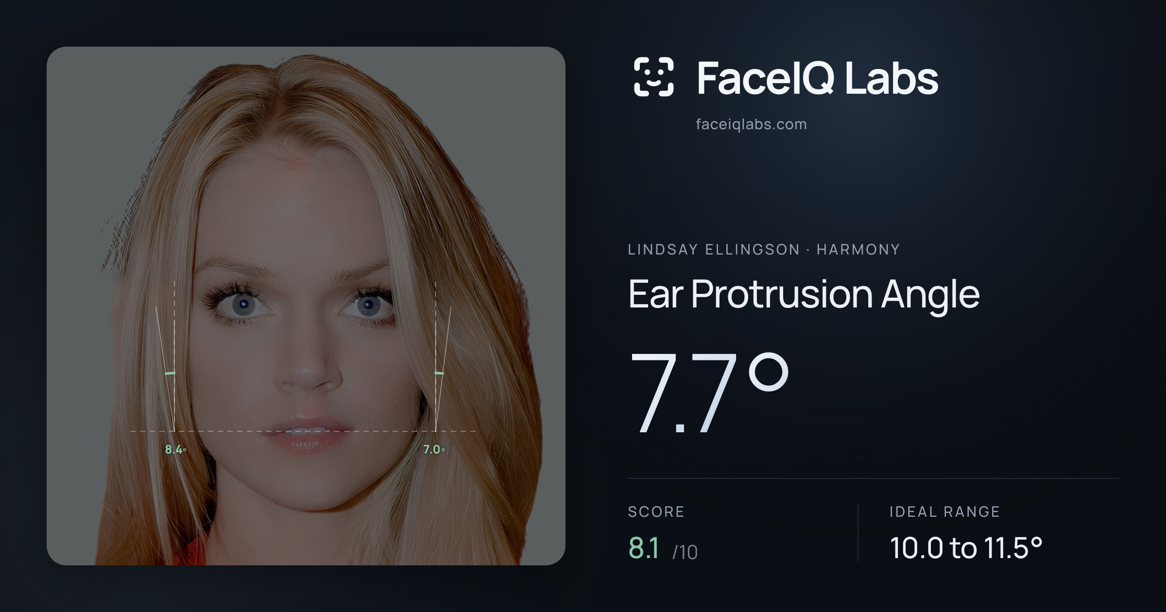Lindsay Ellingson Ear Protrusion Angle: 7.7°, drawn on the photo