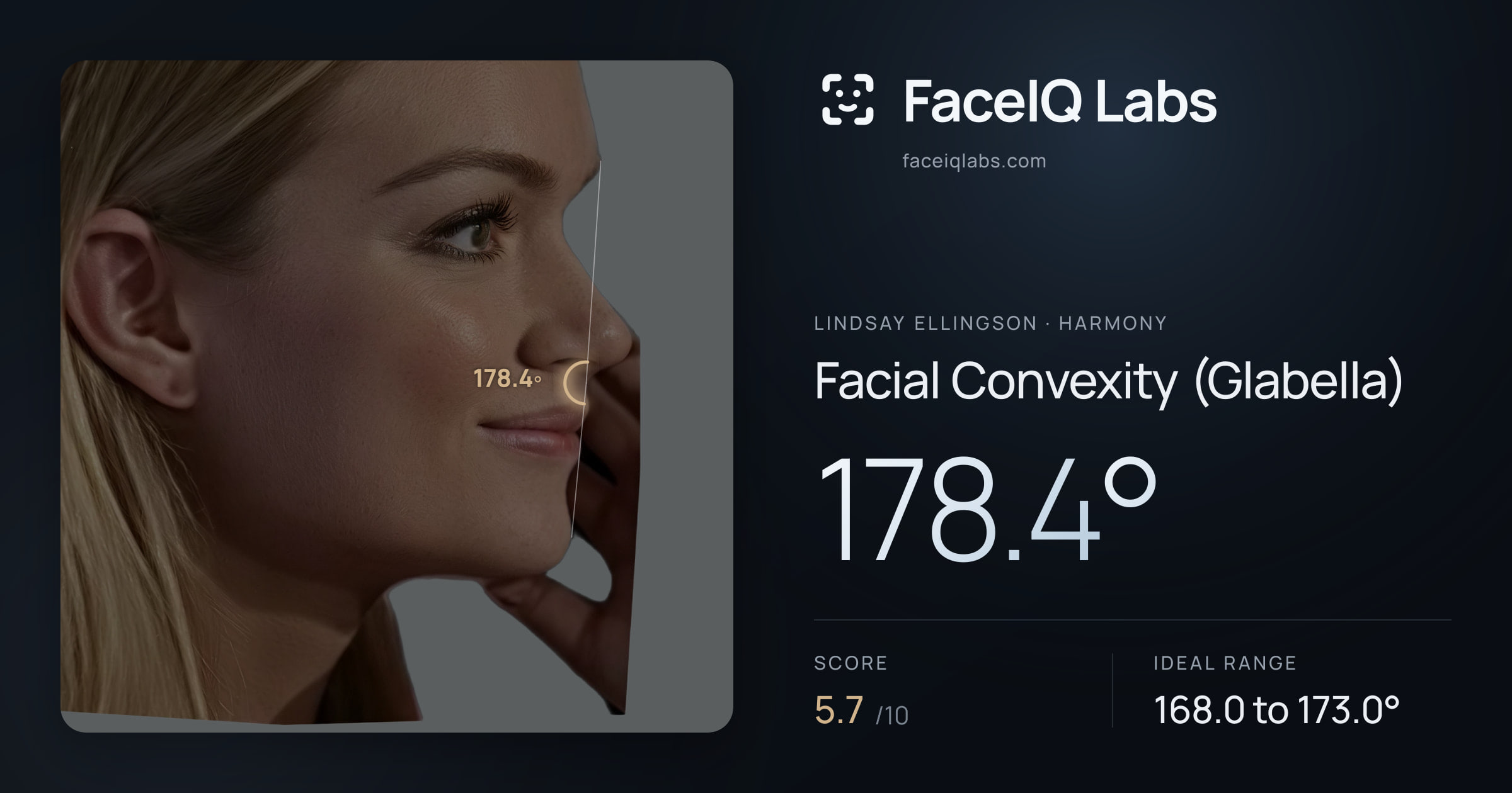 Lindsay Ellingson Facial Convexity (Glabella): 178.4°, drawn on the photo