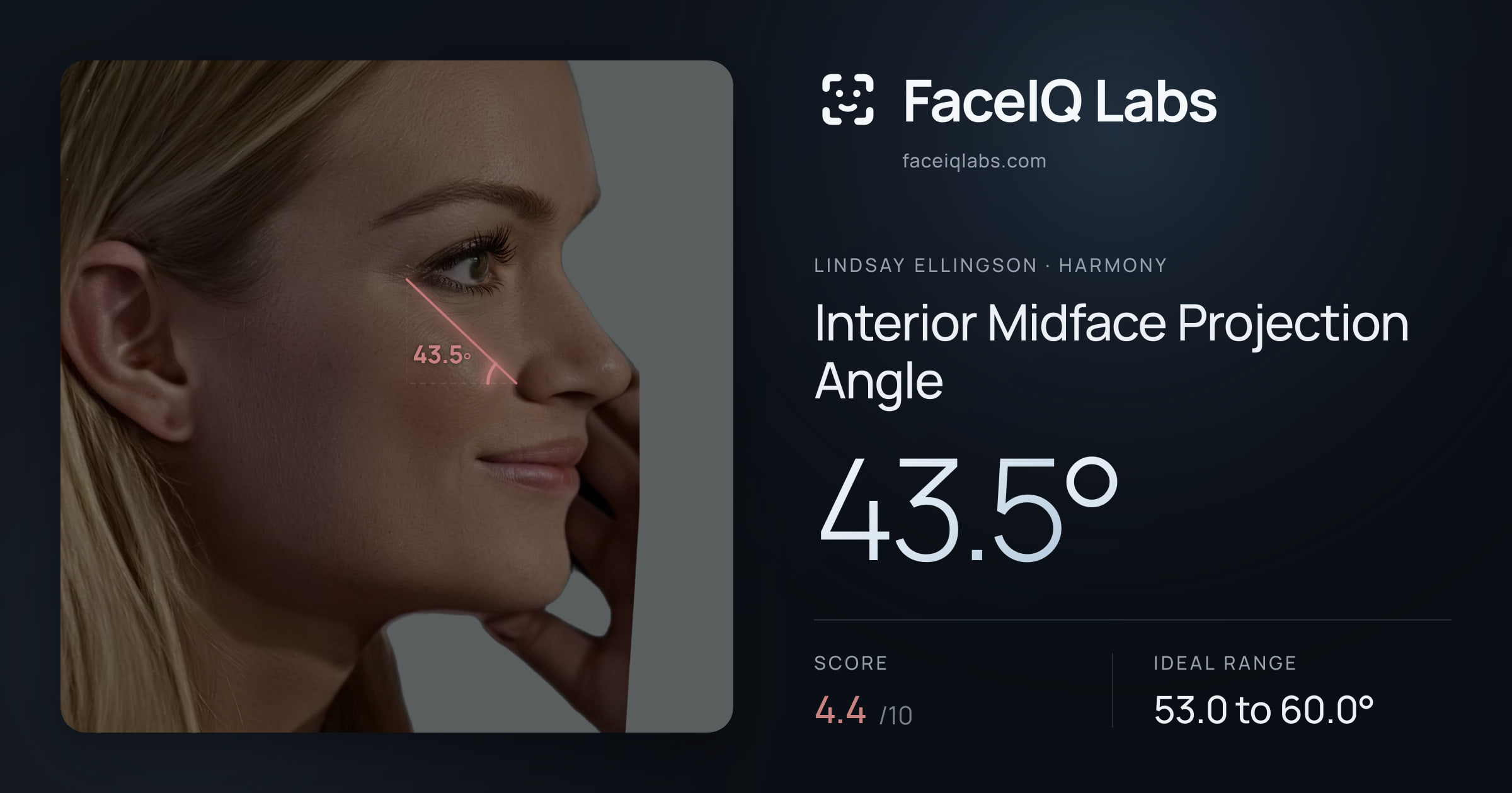 Lindsay Ellingson Interior Midface Projection Angle: 43.5°, drawn on the photo