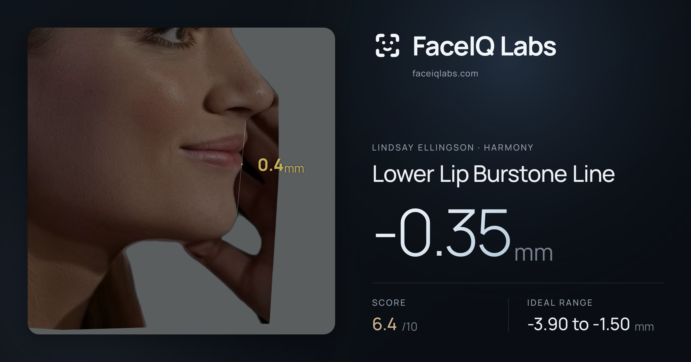 Lindsay Ellingson Lower Lip Burstone Line: -0.35mm, drawn on the photo