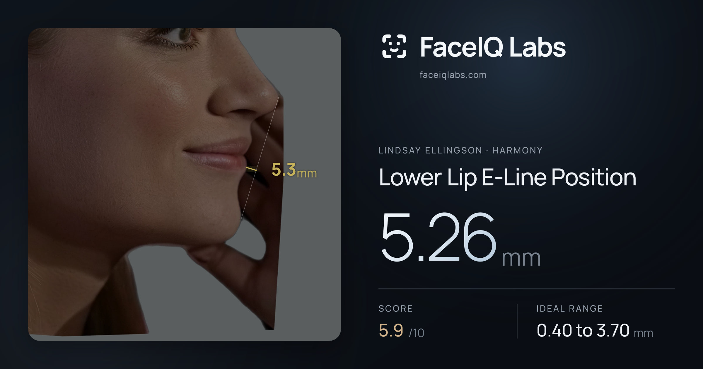 Lindsay Ellingson Lower Lip E-Line Position: 5.26mm, drawn on the photo