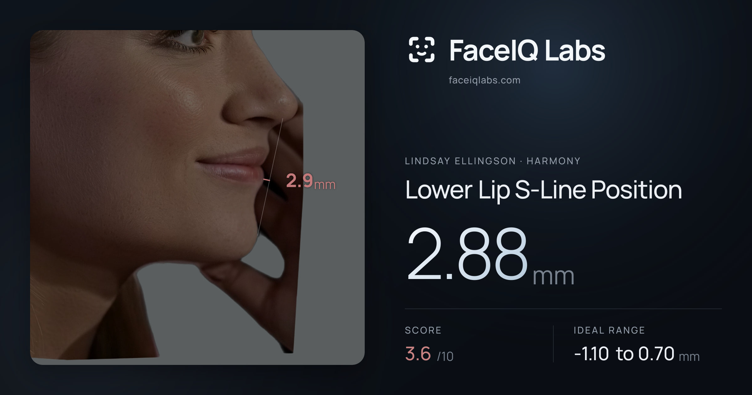 Lindsay Ellingson Lower Lip S-Line Position: 2.88mm, drawn on the photo