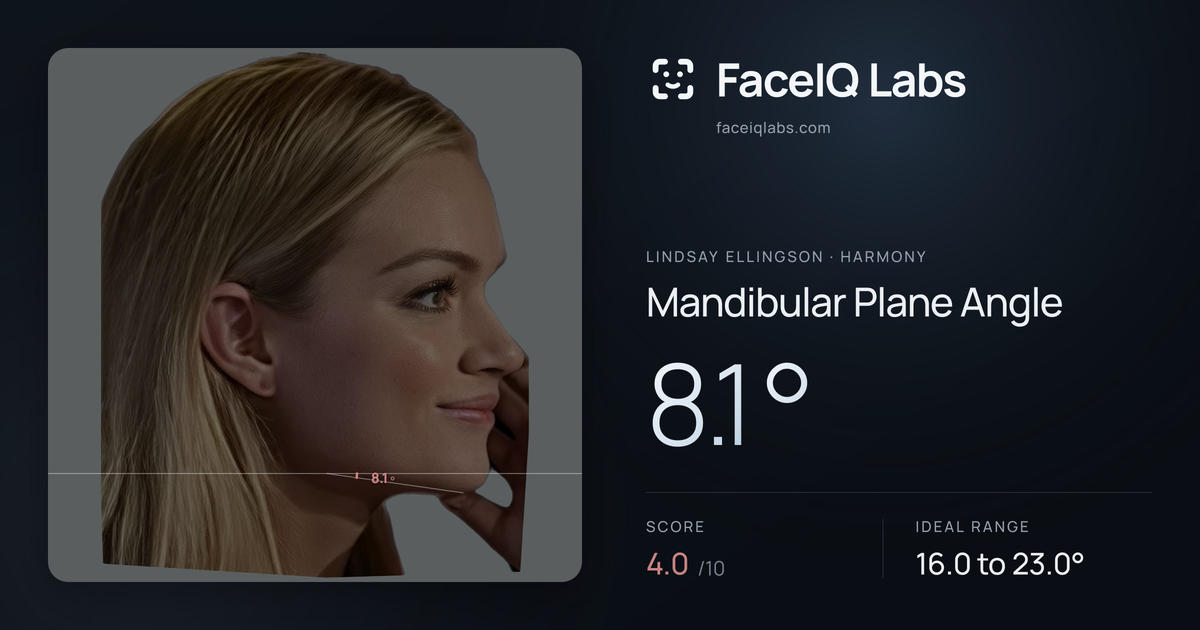 Lindsay Ellingson Mandibular Plane Angle: 8.1°, drawn on the photo