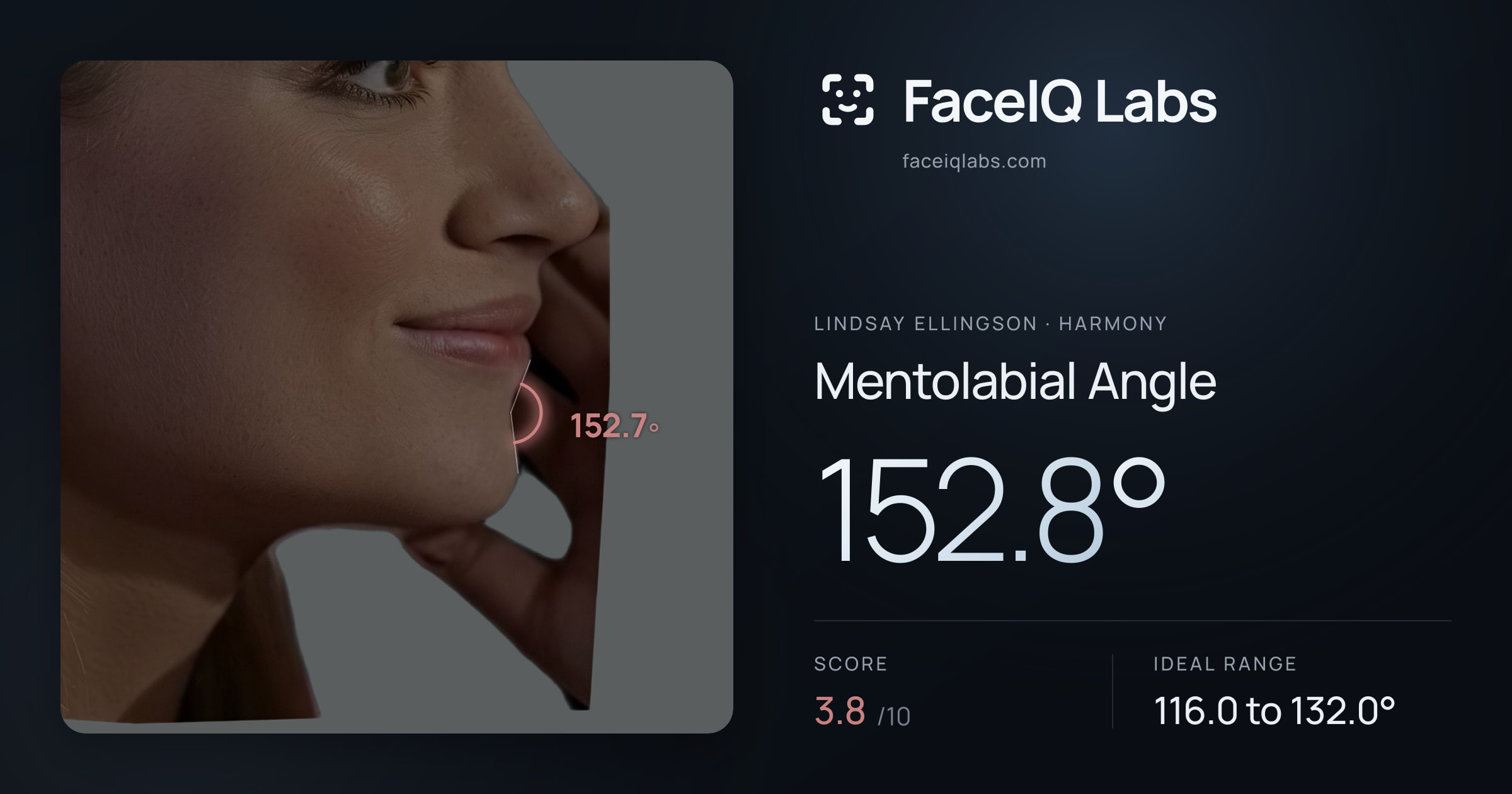 Lindsay Ellingson Mentolabial Angle: 152.8°, drawn on the photo