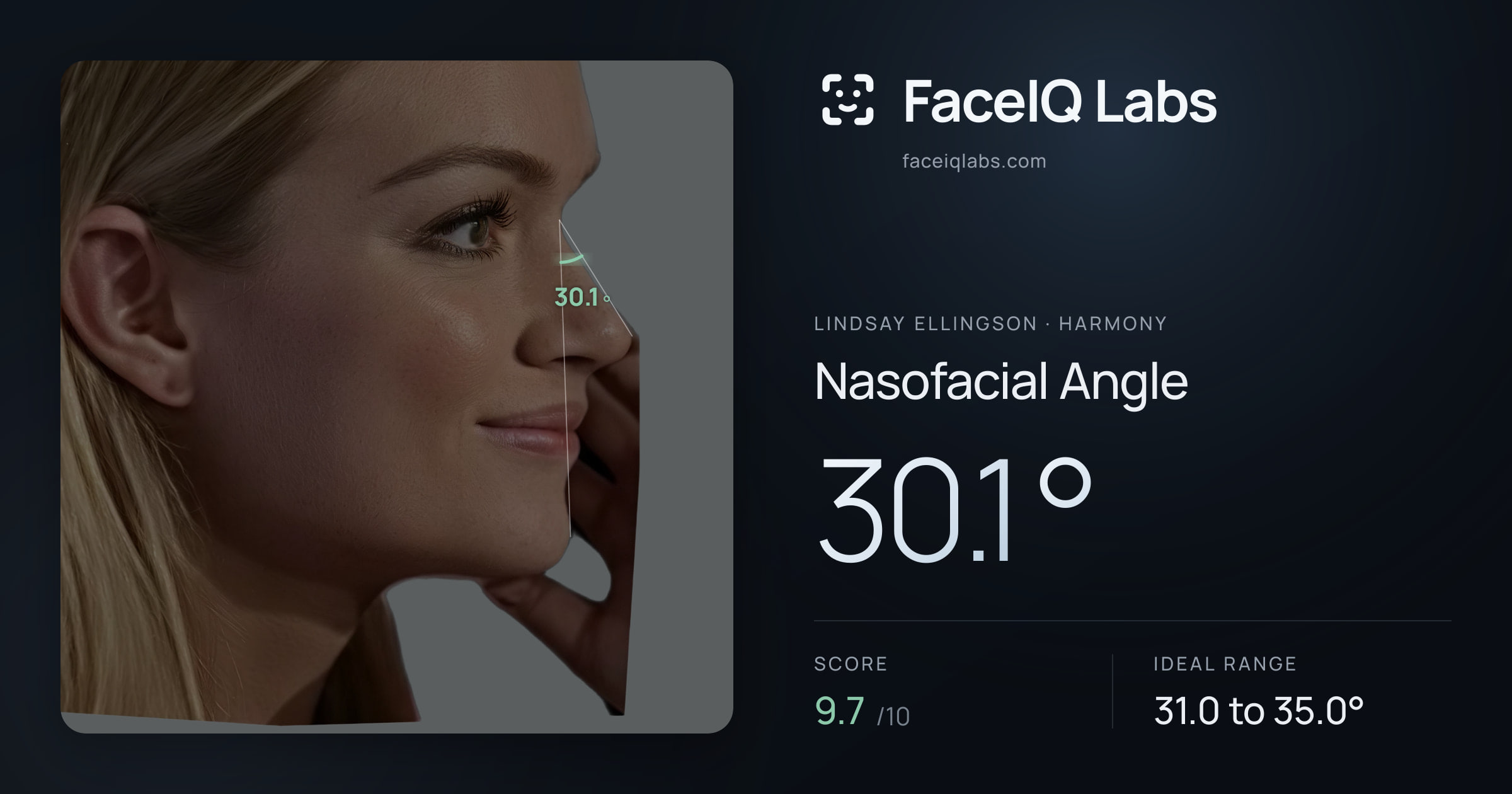 Lindsay Ellingson Nasofacial Angle: 30.1°, drawn on the photo
