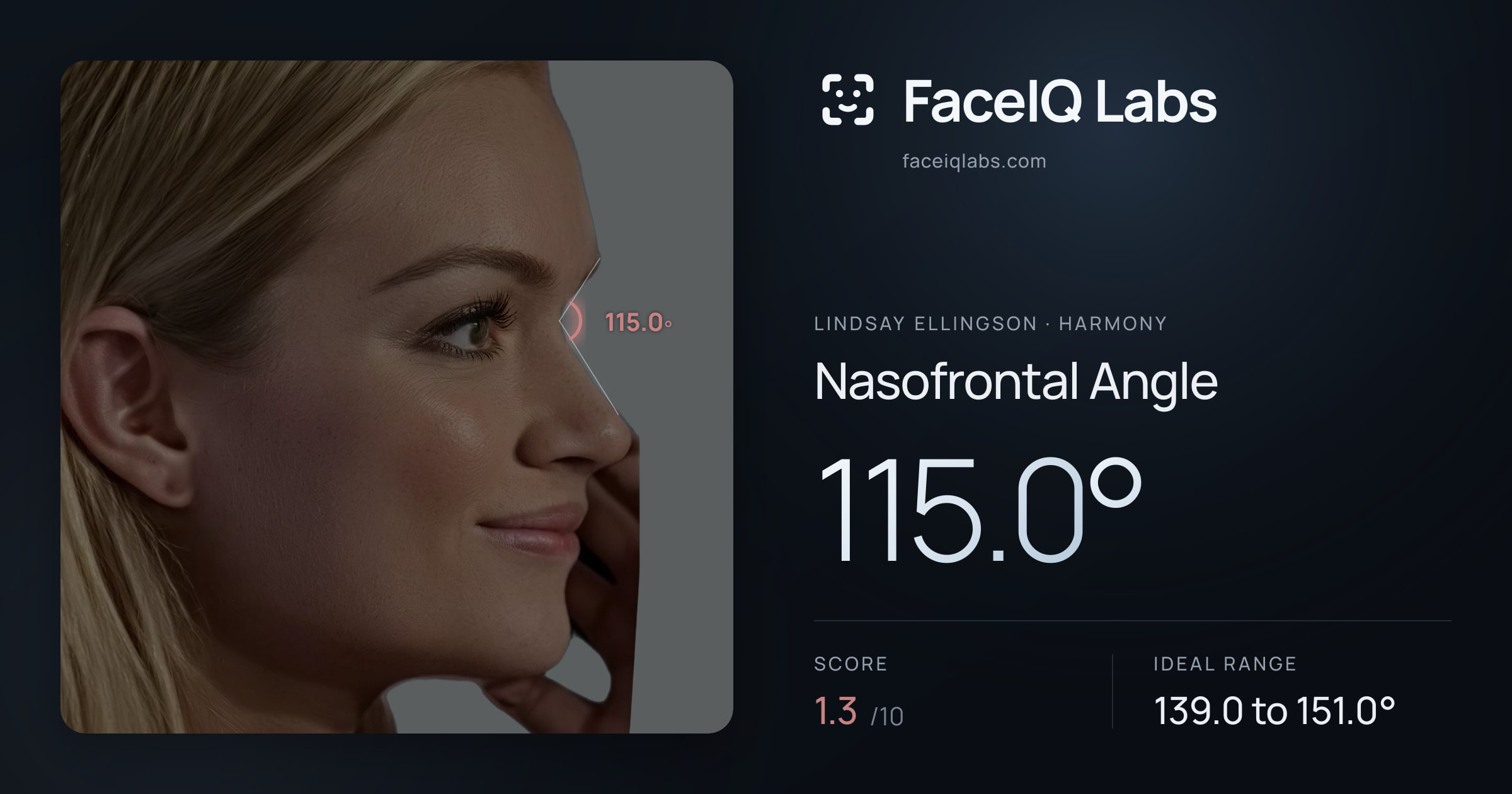 Lindsay Ellingson Nasofrontal Angle: 115.0°, drawn on the photo