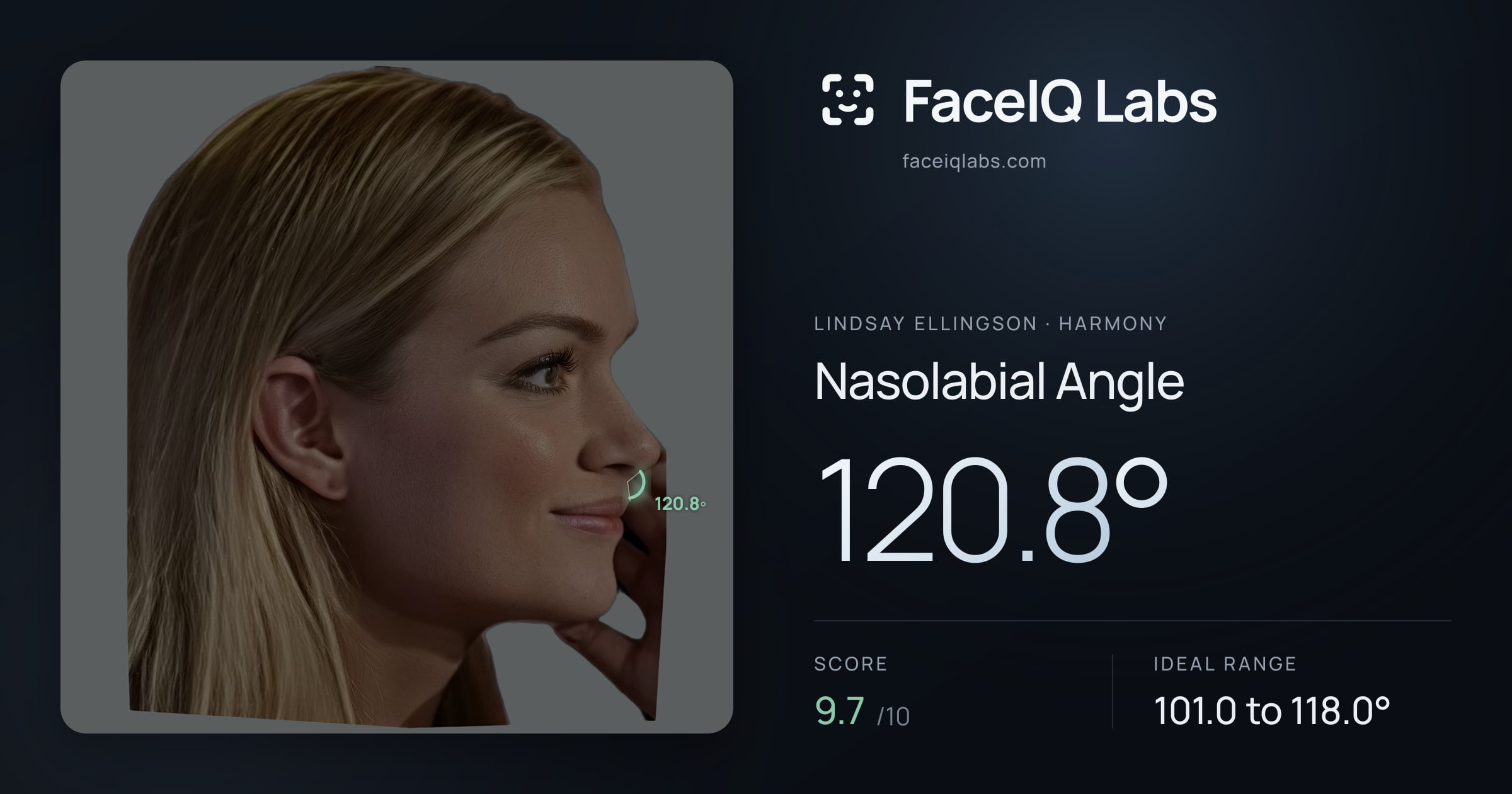 Lindsay Ellingson Nasolabial Angle: 120.8°, drawn on the photo