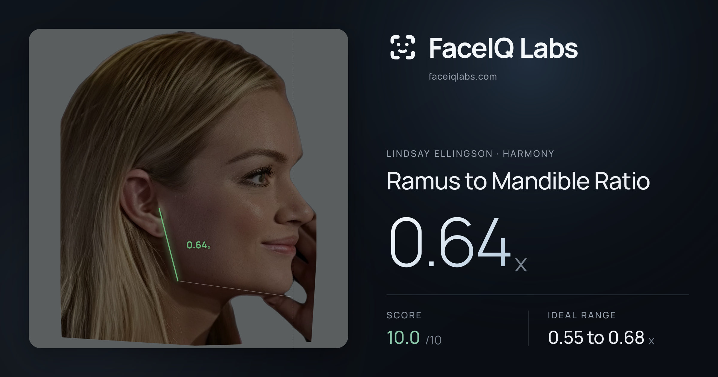 Lindsay Ellingson Ramus to Mandible Ratio: 0.64x, drawn on the photo