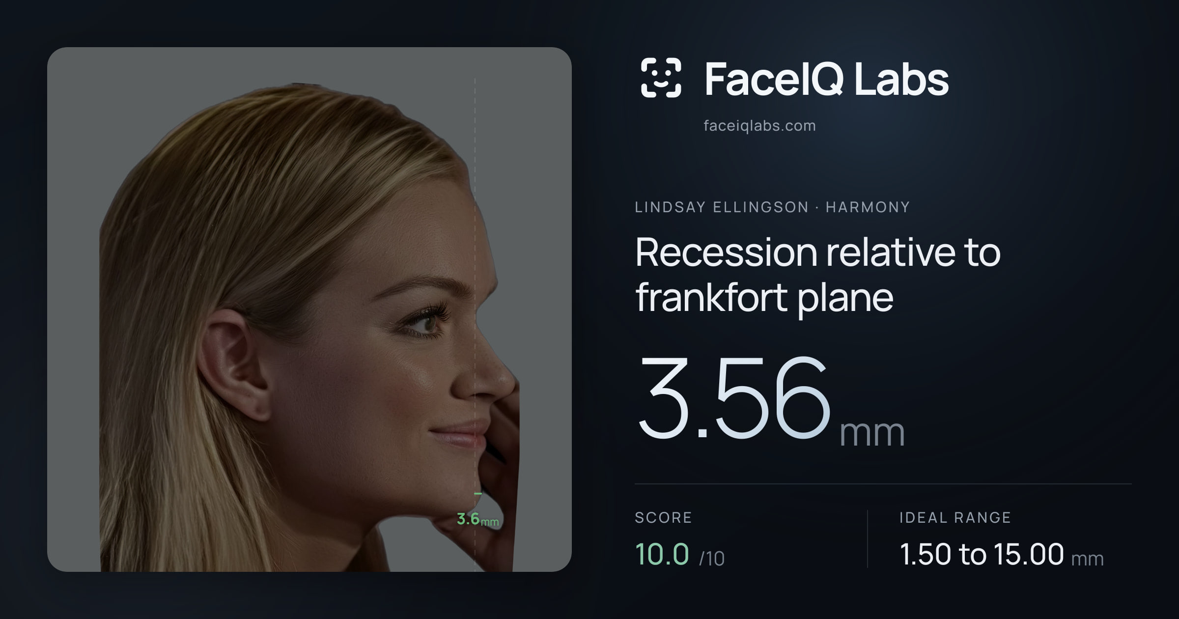 Lindsay Ellingson Recession relative to frankfort plane: 3.56mm, drawn on the photo