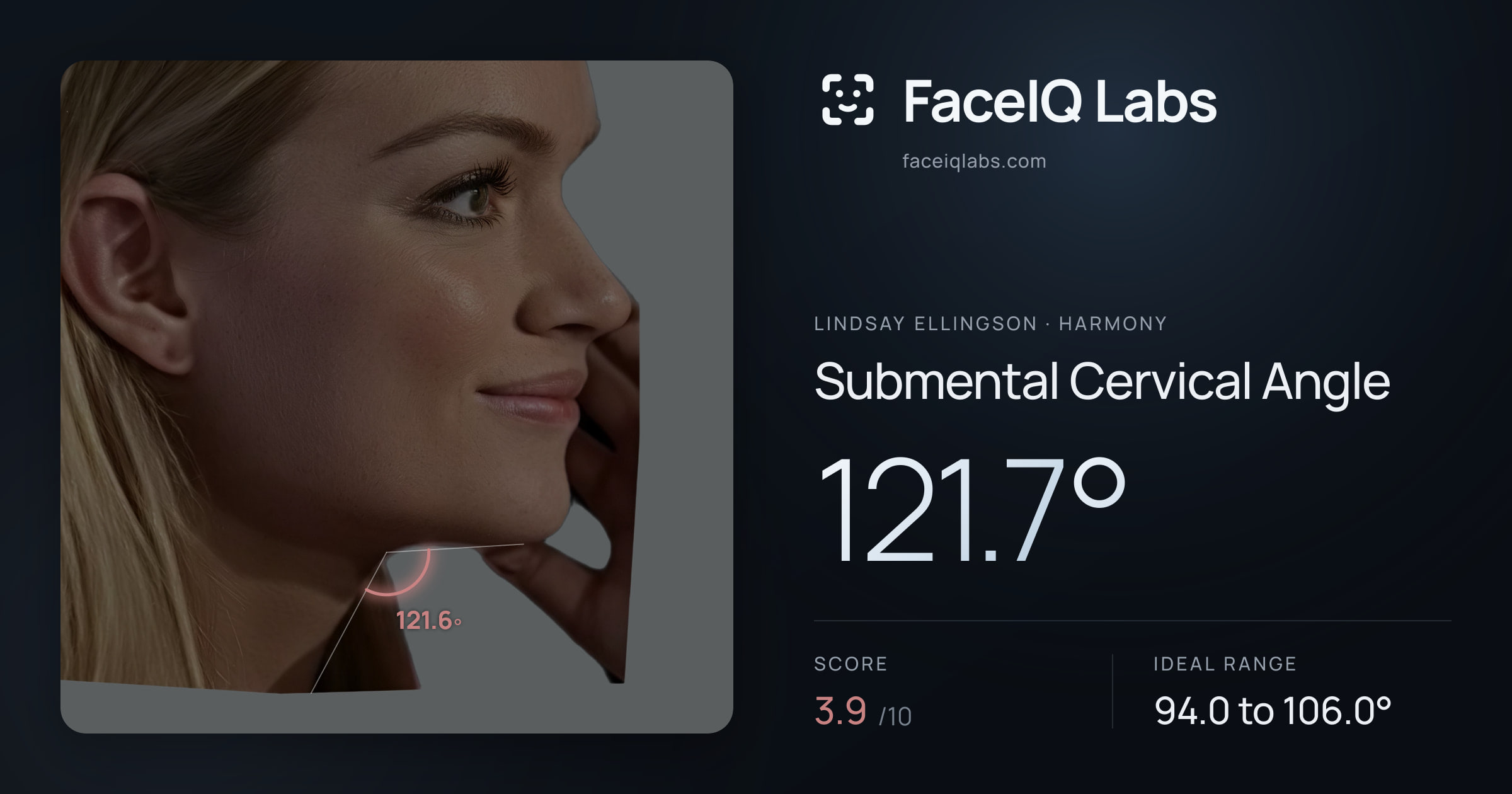 Lindsay Ellingson Submental Cervical Angle: 121.7°, drawn on the photo