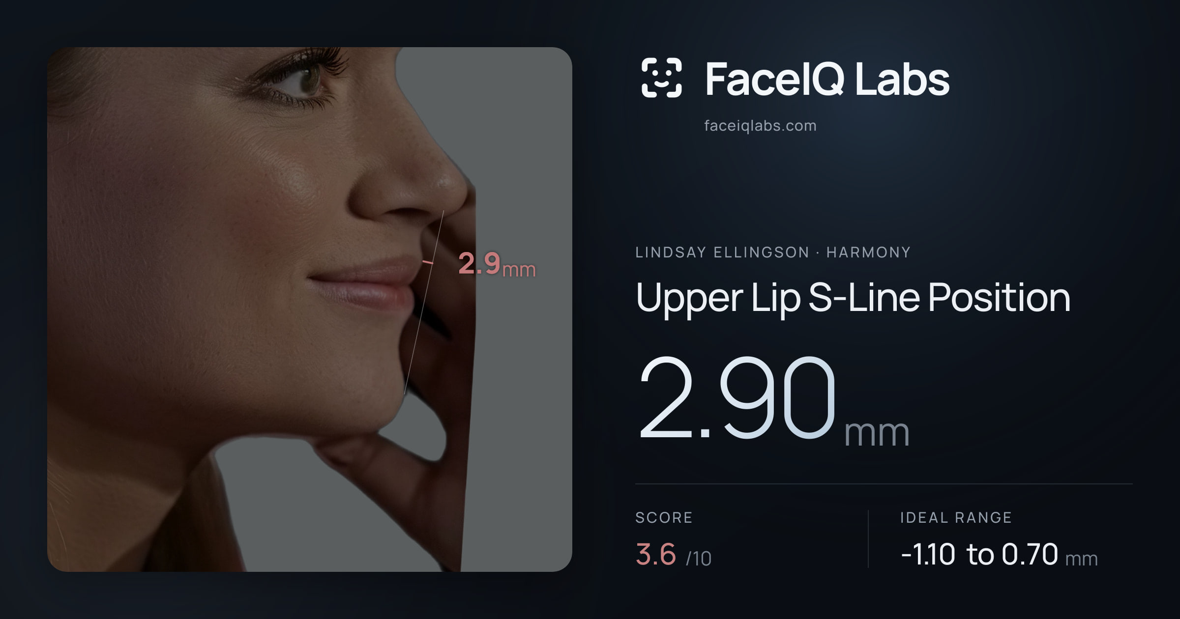 Lindsay Ellingson Upper Lip S-Line Position: 2.90mm, drawn on the photo
