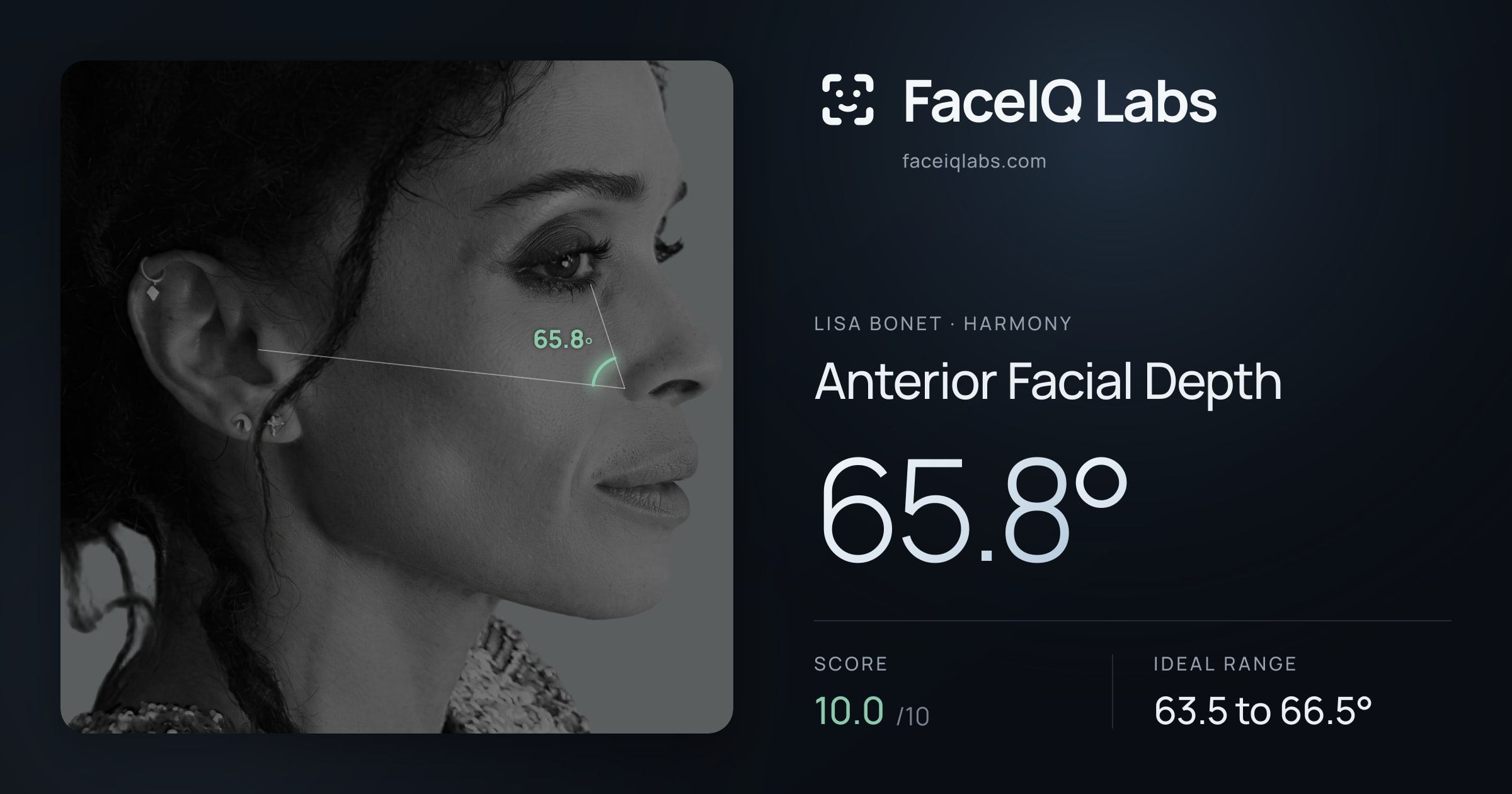 Lisa Bonet Anterior Facial Depth: 65.8°, drawn on the photo