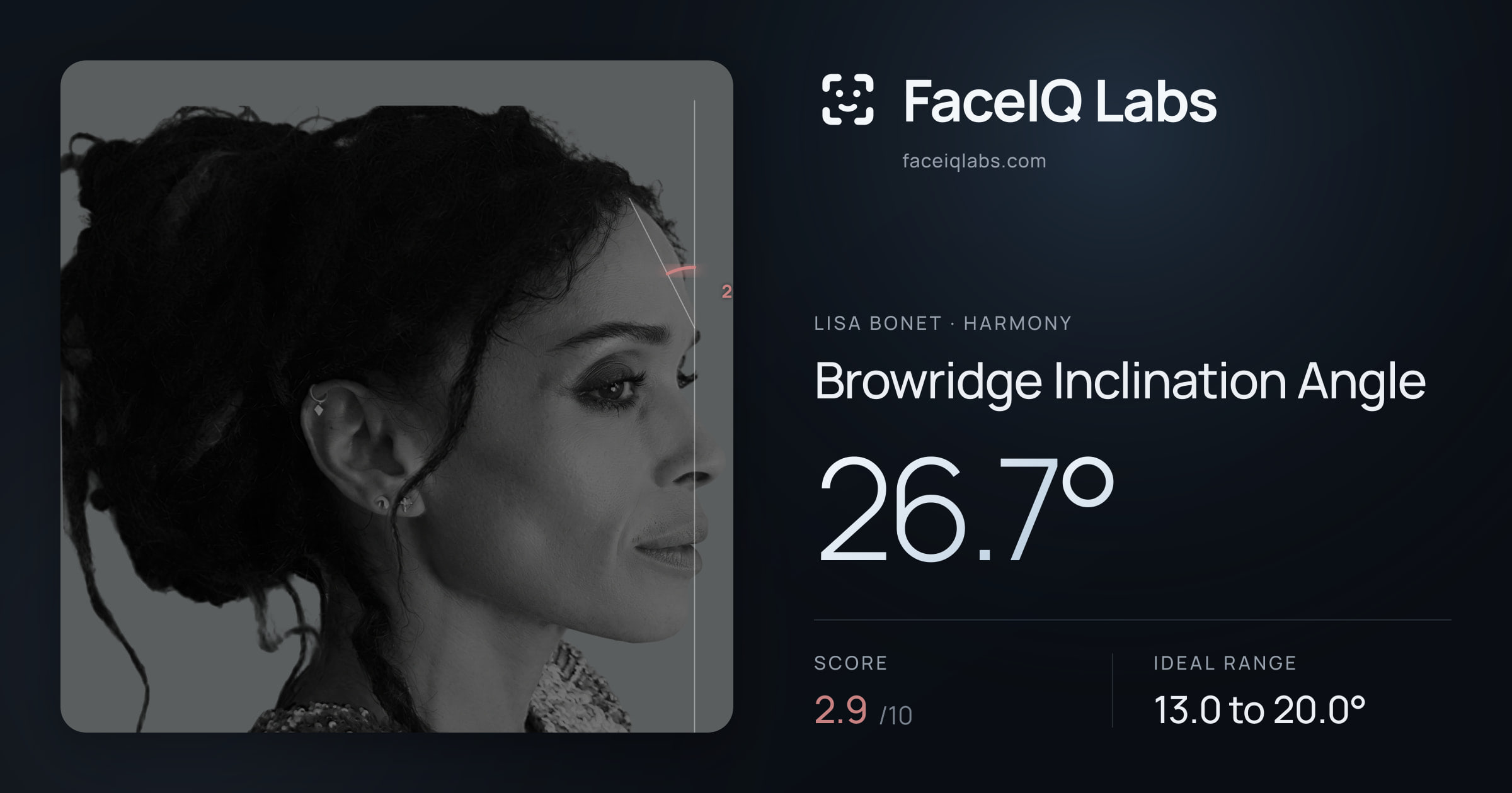 Lisa Bonet Browridge Inclination Angle: 26.7°, drawn on the photo