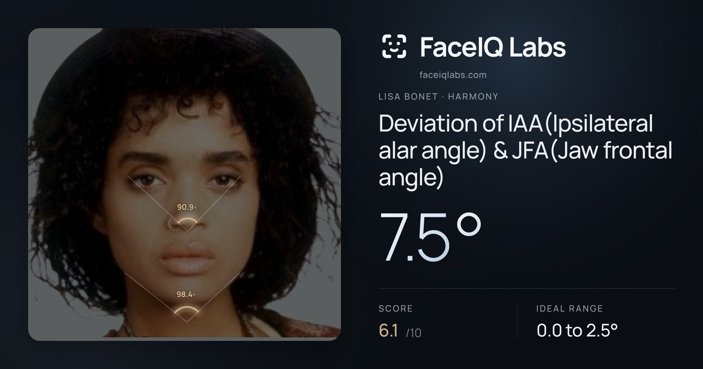 Lisa Bonet Deviation of IAA(Ipsilateral alar angle) & JFA(Jaw frontal angle): 7.5°, drawn on the photo