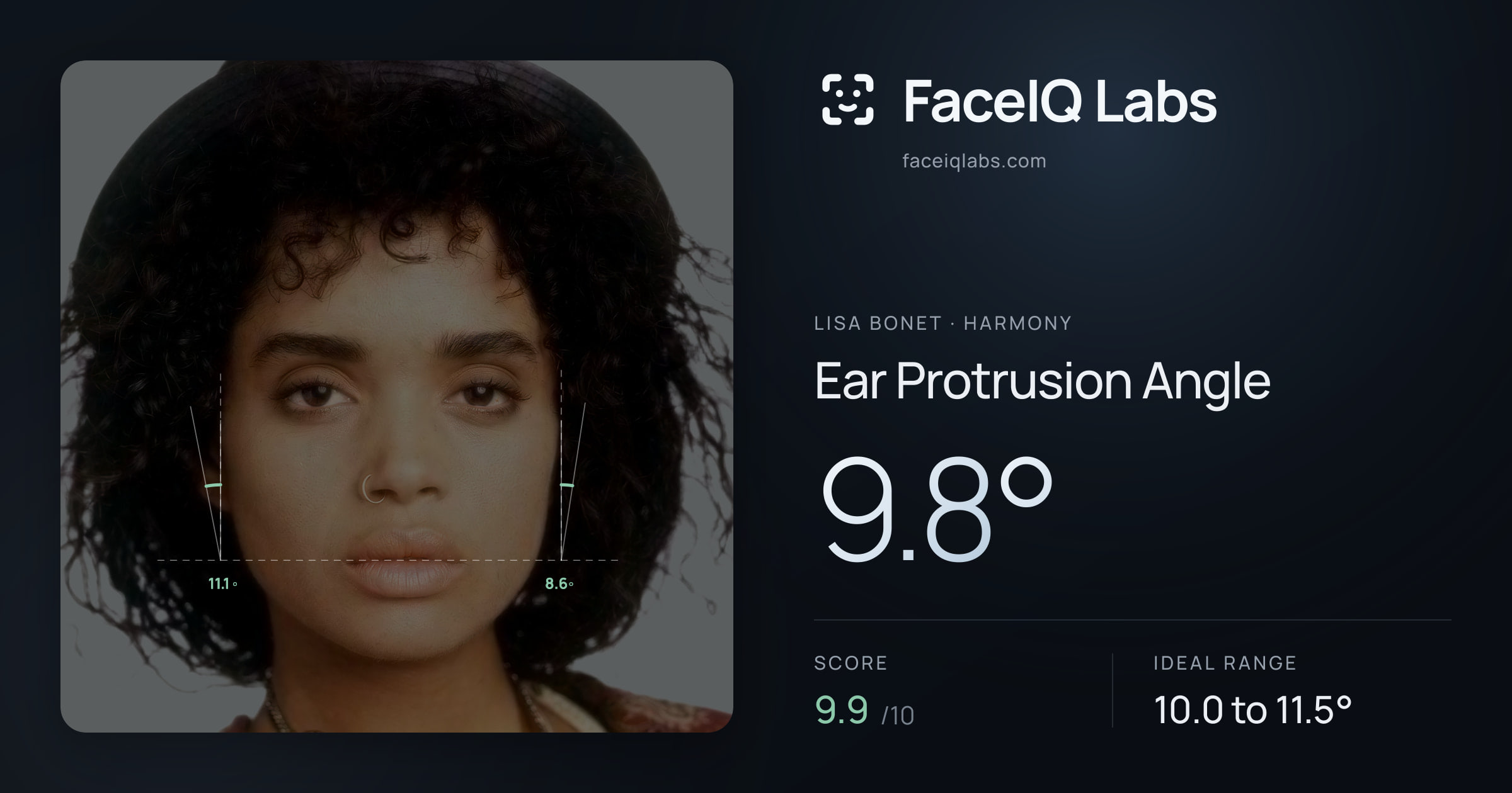 Lisa Bonet Ear Protrusion Angle: 9.8°, drawn on the photo