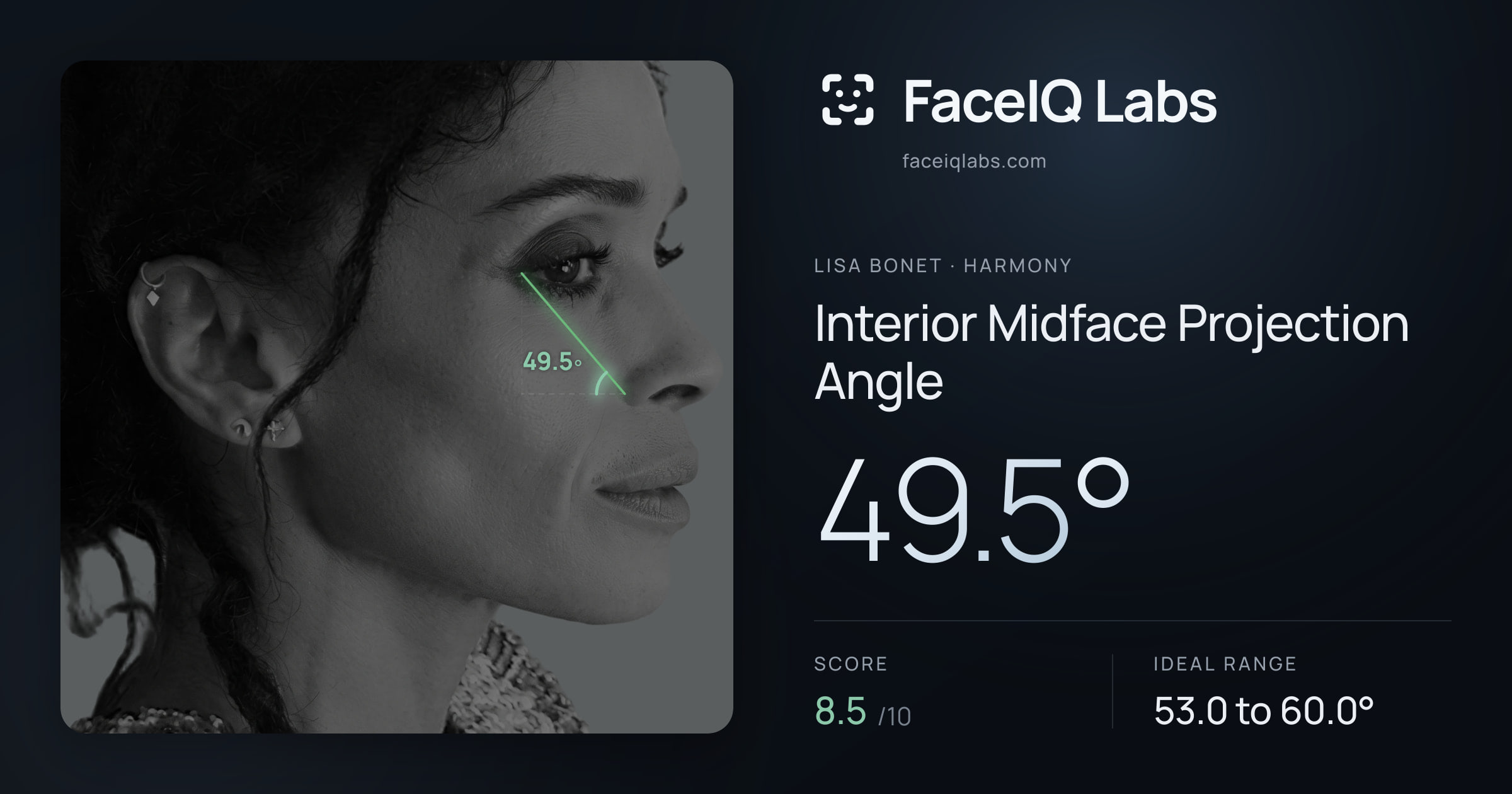 Lisa Bonet Interior Midface Projection Angle: 49.5°, drawn on the photo