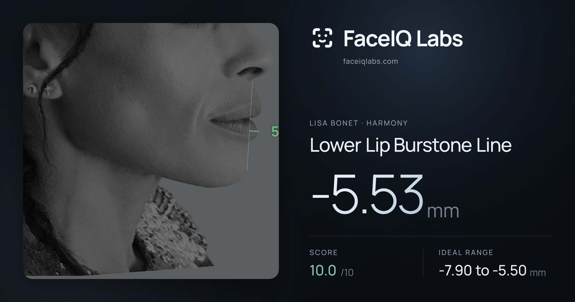 Lisa Bonet Lower Lip Burstone Line: -5.53mm, drawn on the photo