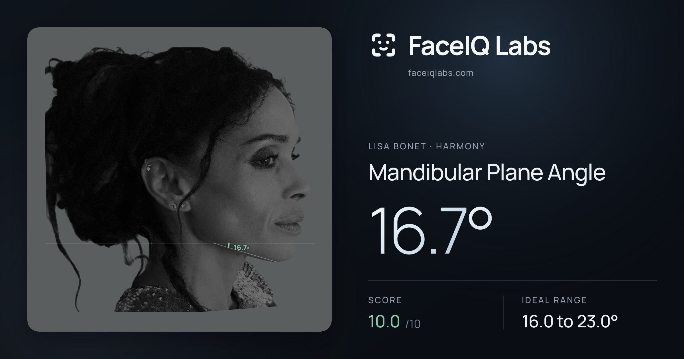 Lisa Bonet Mandibular Plane Angle: 16.7°, drawn on the photo