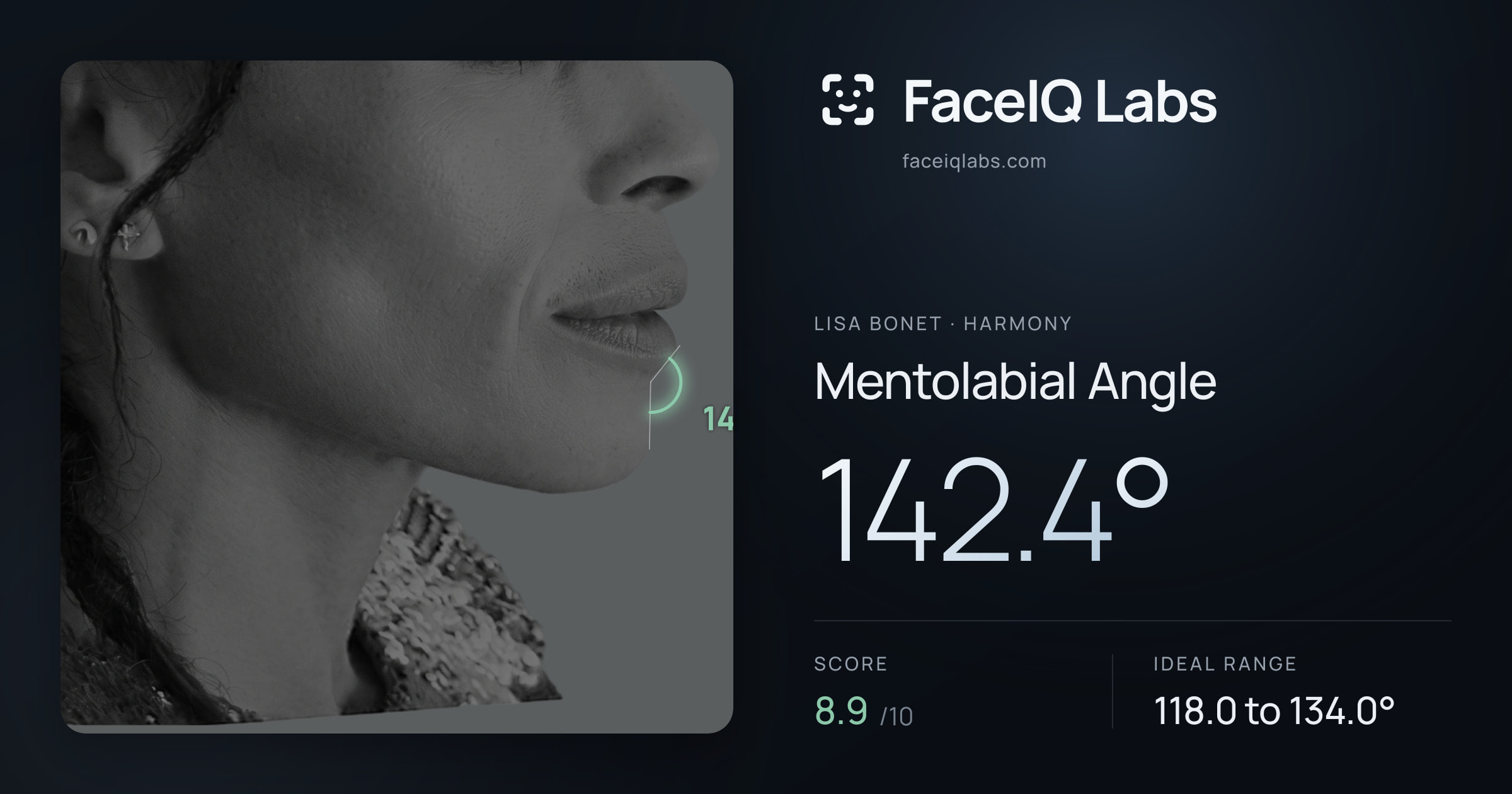 Lisa Bonet Mentolabial Angle: 142.4°, drawn on the photo