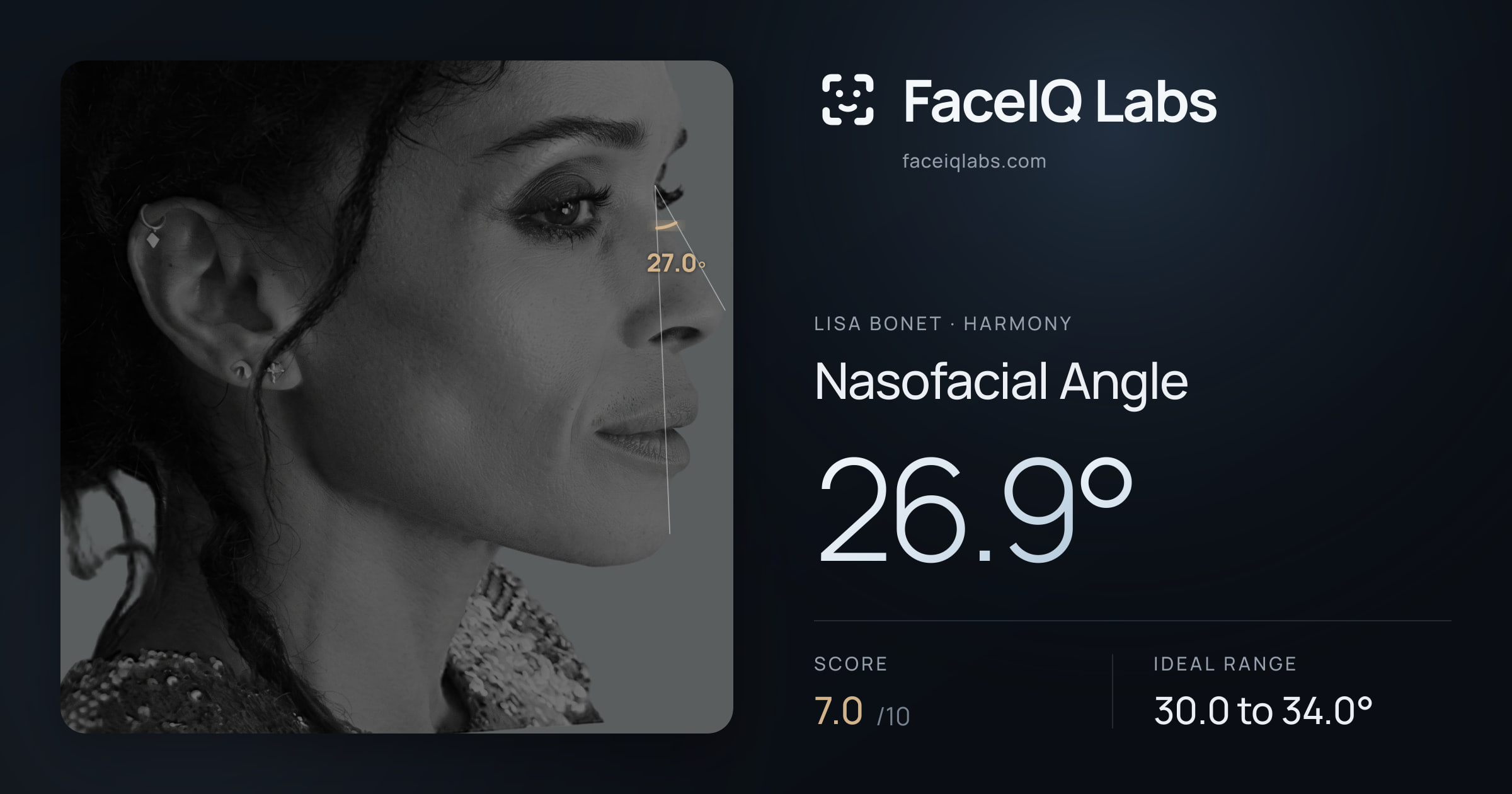 Lisa Bonet Nasofacial Angle: 26.9°, drawn on the photo