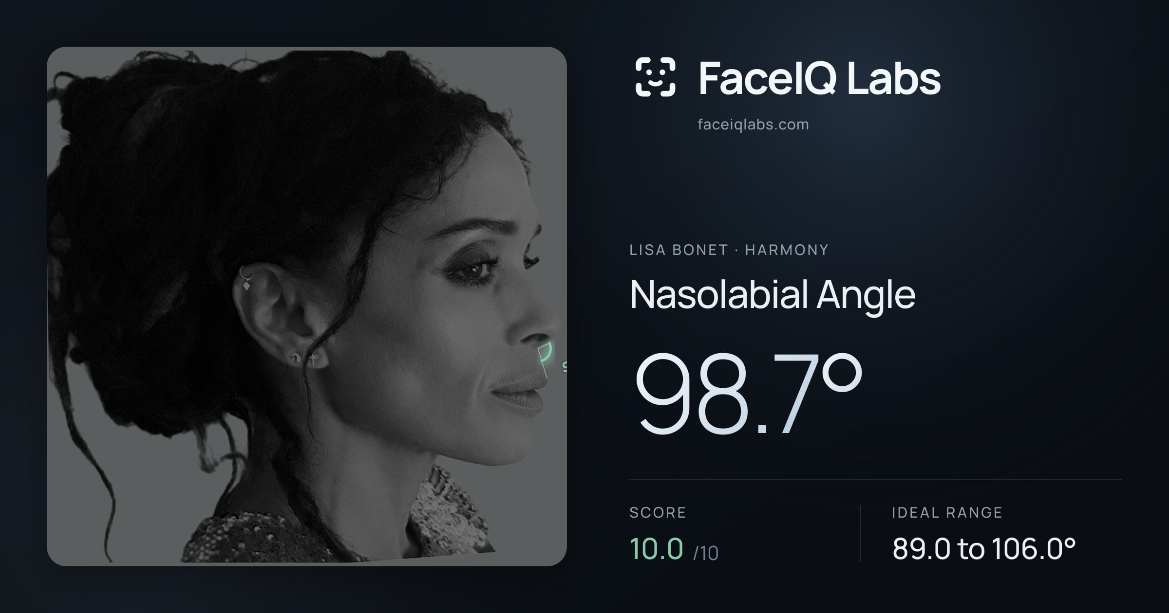 Lisa Bonet Nasolabial Angle: 98.7°, drawn on the photo