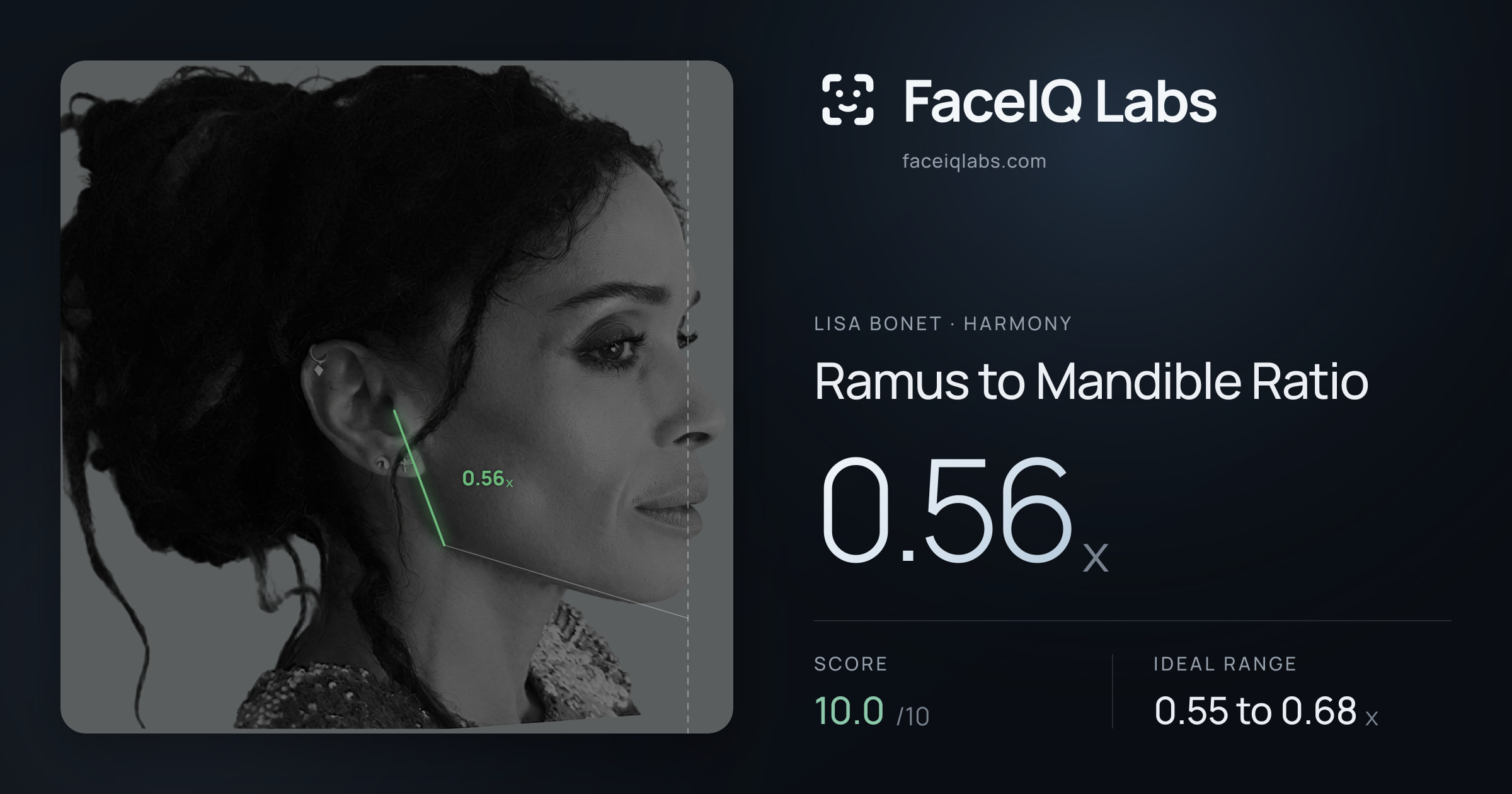 Lisa Bonet Ramus to Mandible Ratio: 0.56x, drawn on the photo