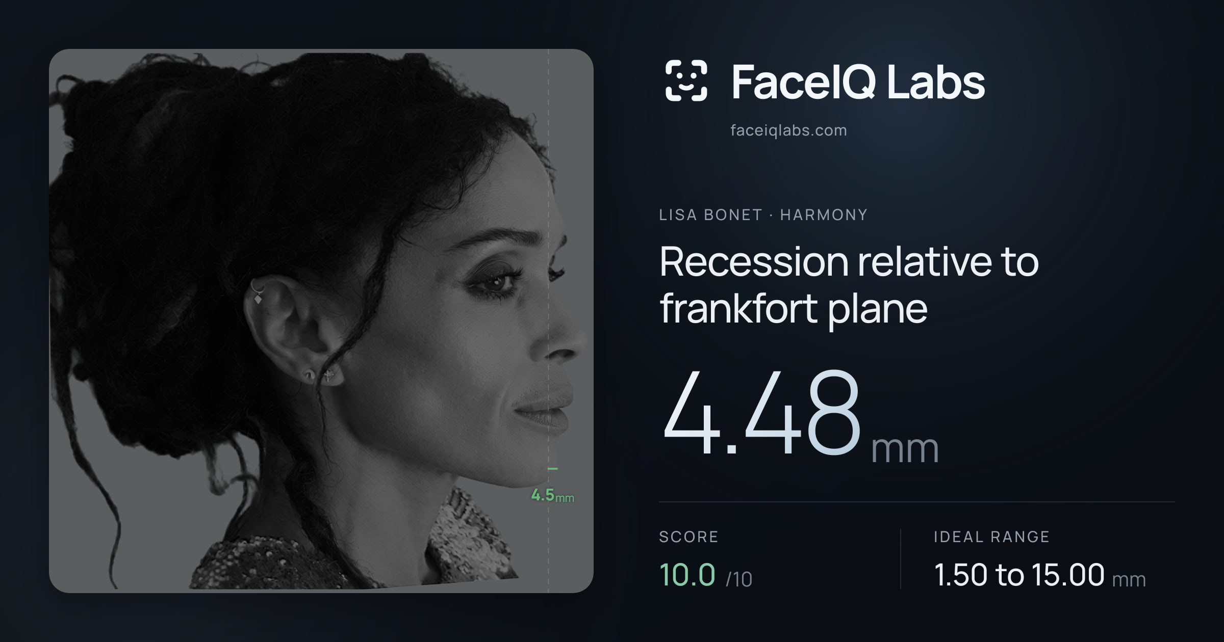 Lisa Bonet Recession relative to frankfort plane: 4.48mm, drawn on the photo