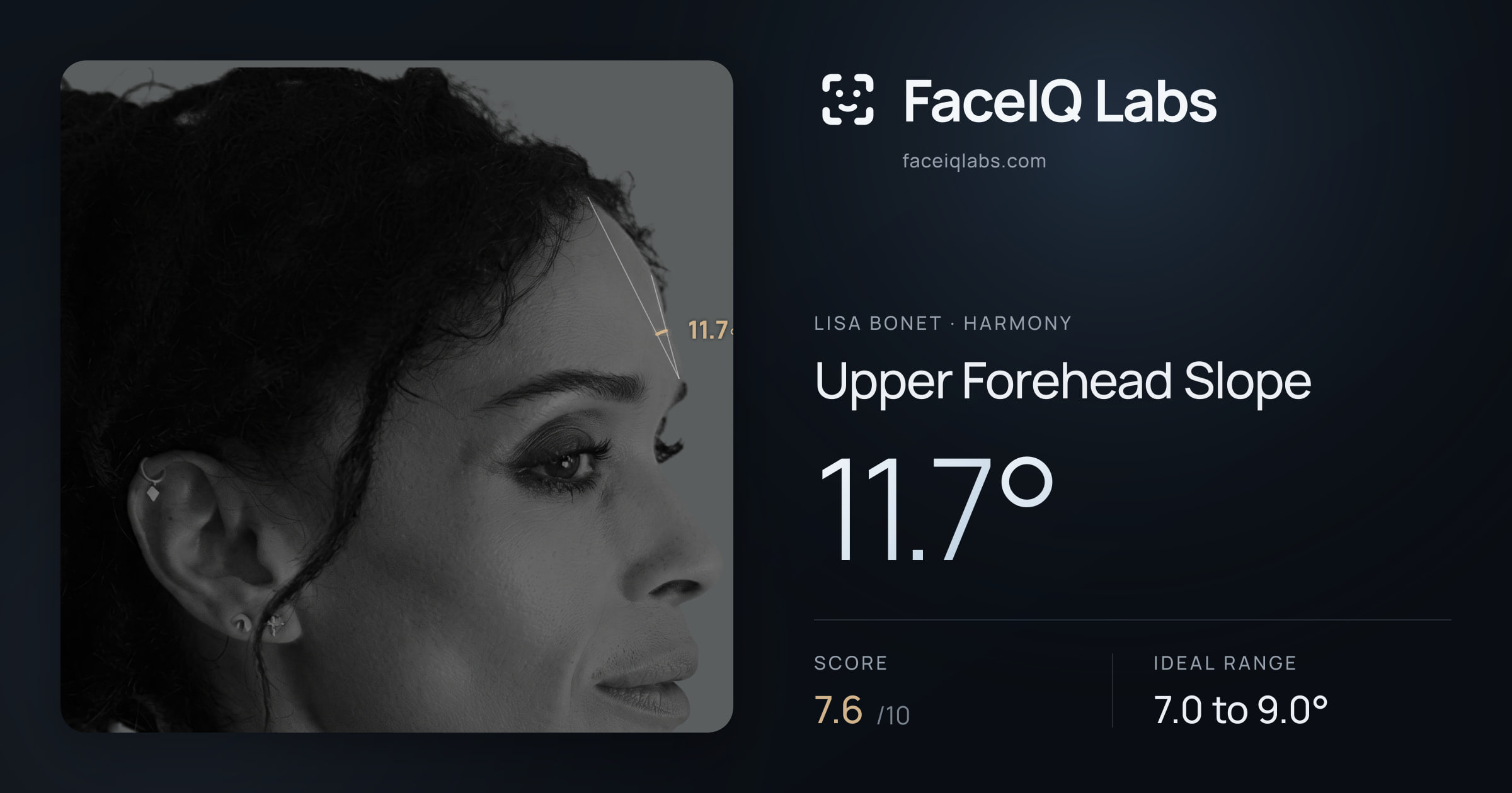 Lisa Bonet Upper Forehead Slope: 11.7°, drawn on the photo