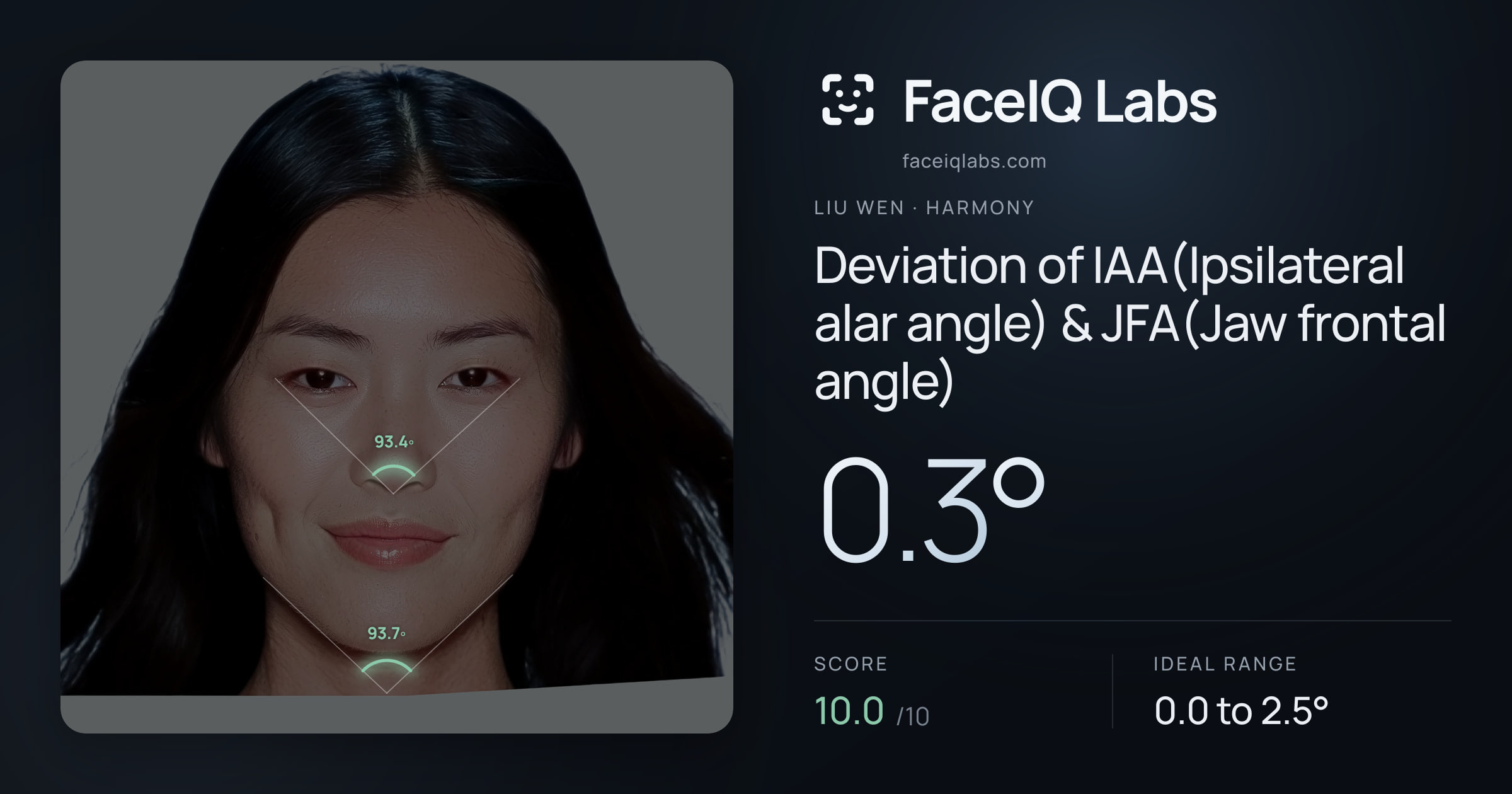 Liu Wen Deviation of IAA(Ipsilateral alar angle) & JFA(Jaw frontal angle): 0.3°, drawn on the photo