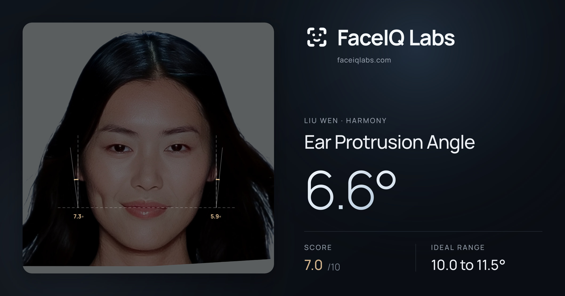 Liu Wen Ear Protrusion Angle: 6.6°, drawn on the photo