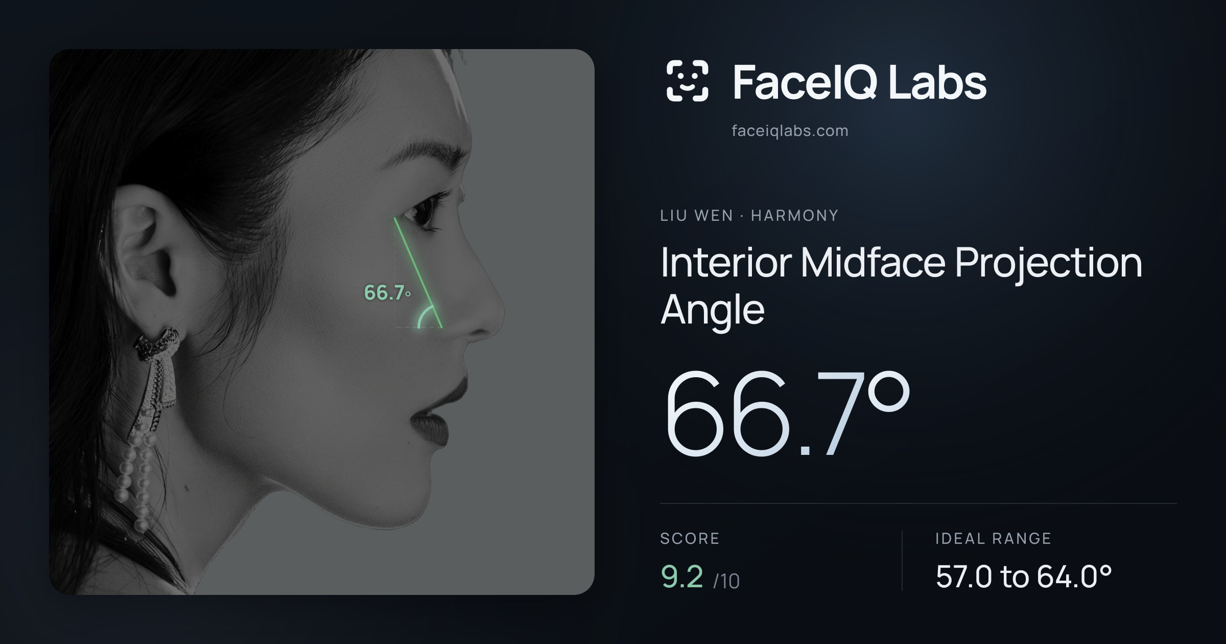 Liu Wen Interior Midface Projection Angle: 66.7°, drawn on the photo