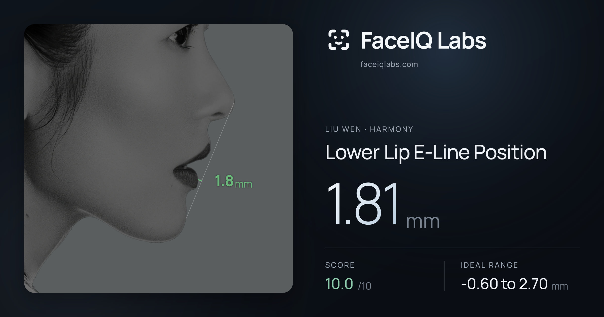Liu Wen Lower Lip E-Line Position: 1.81mm, drawn on the photo