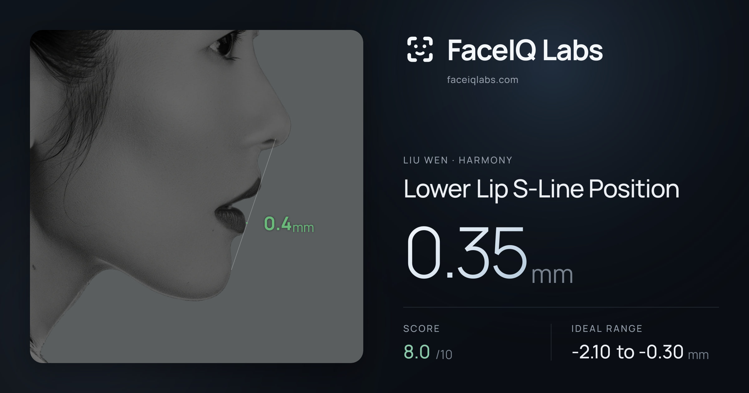 Liu Wen Lower Lip S-Line Position: 0.35mm, drawn on the photo
