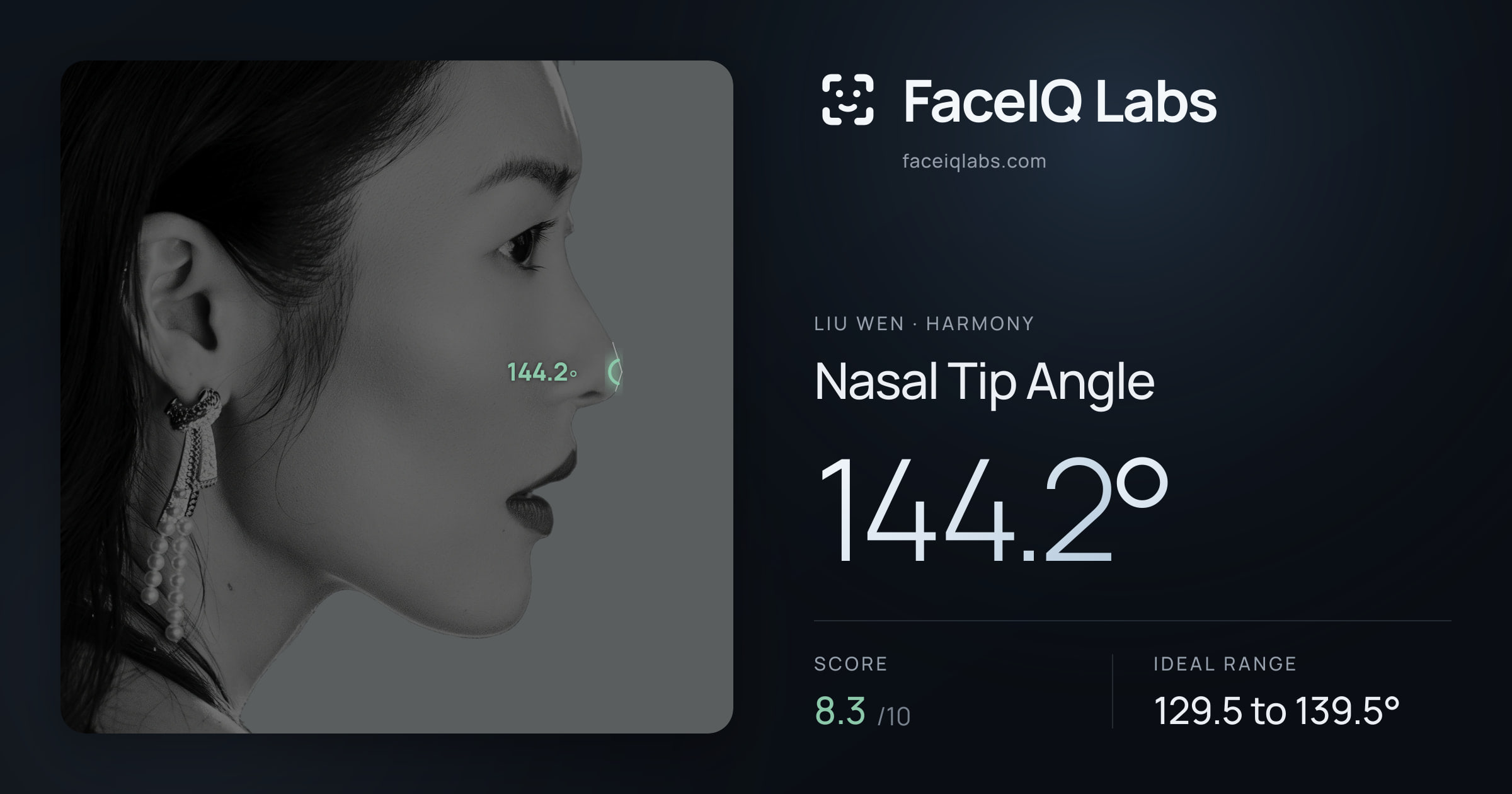 Liu Wen Nasal Tip Angle: 144.2°, drawn on the photo