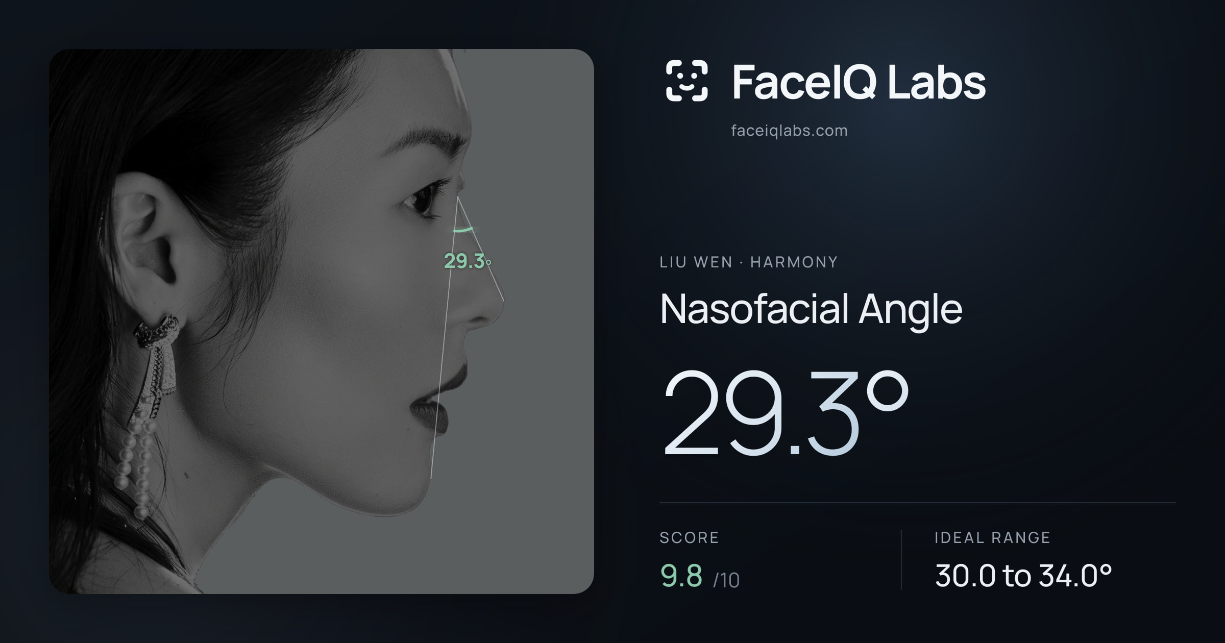 Liu Wen Nasofacial Angle: 29.3°, drawn on the photo