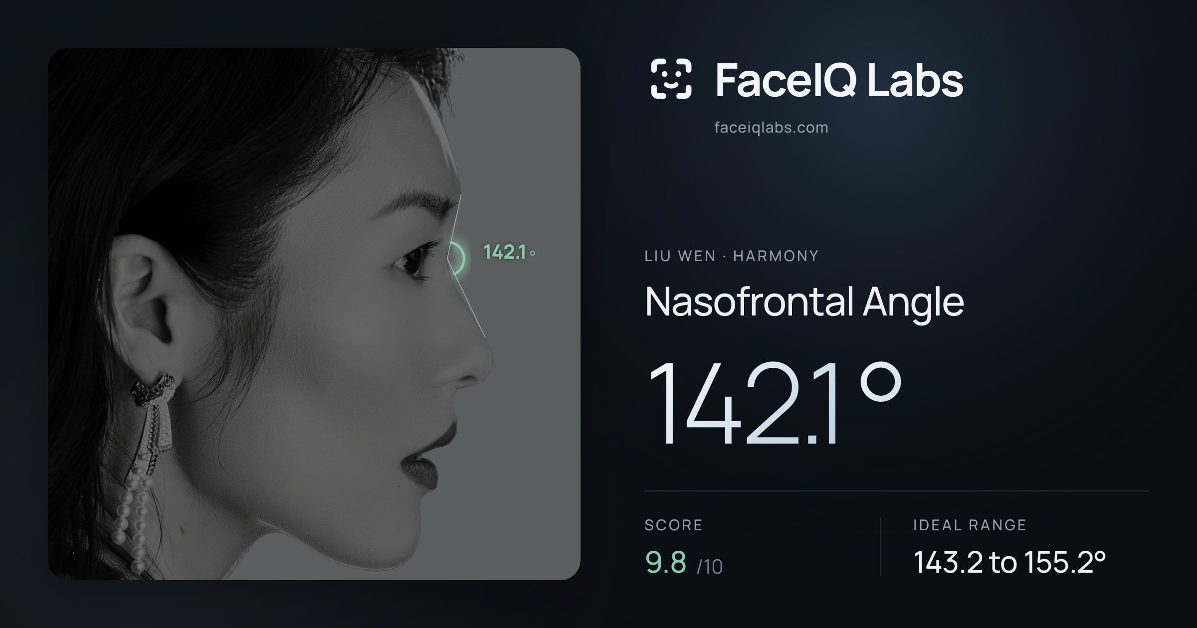 Liu Wen Nasofrontal Angle: 142.1°, drawn on the photo