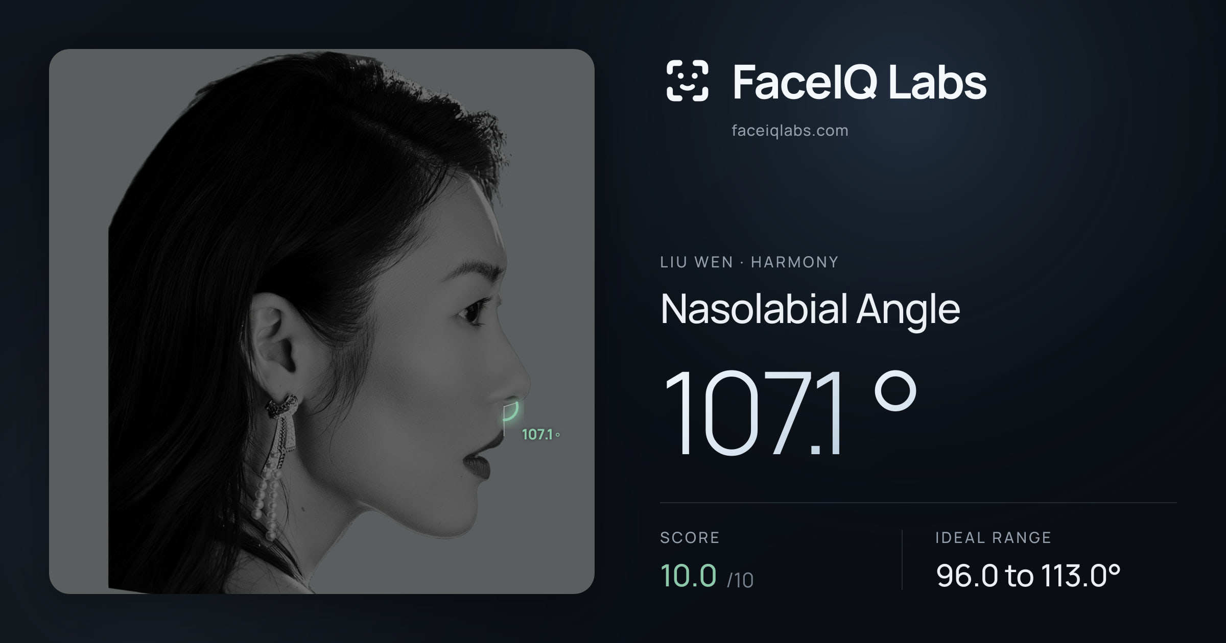 Liu Wen Nasolabial Angle: 107.1°, drawn on the photo